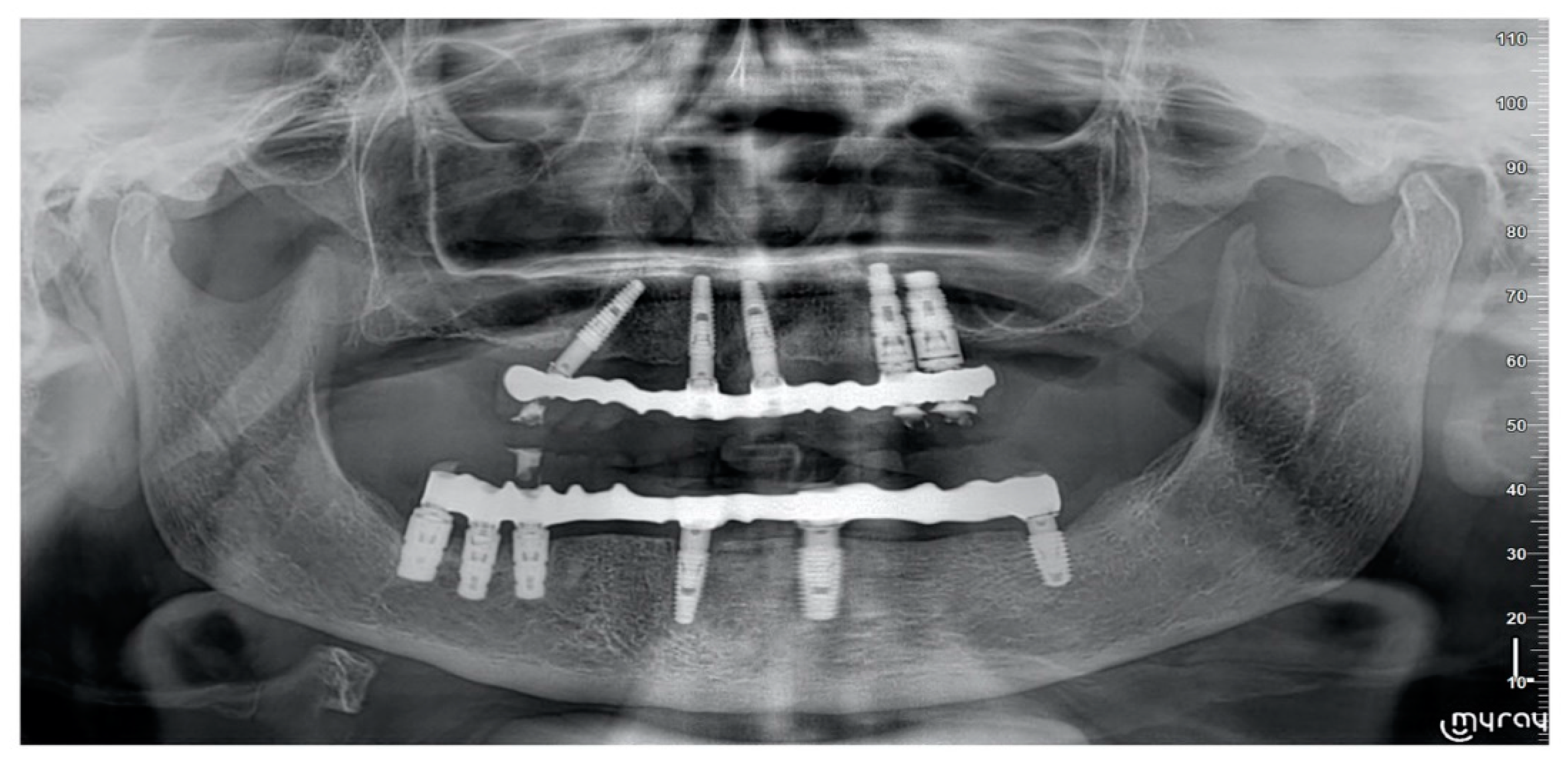 Prosthesis 02 00033 g006 Prosthesis 02 00033 g006