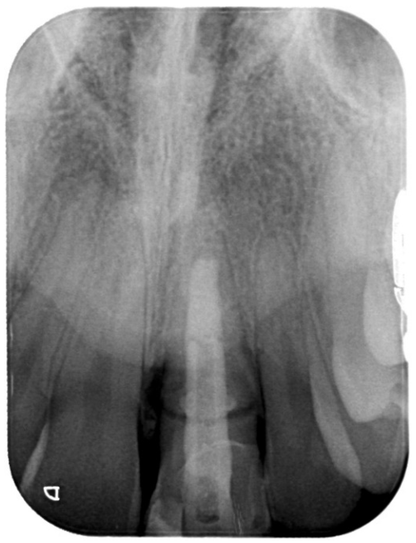 Prosthesis 03 00021 g005