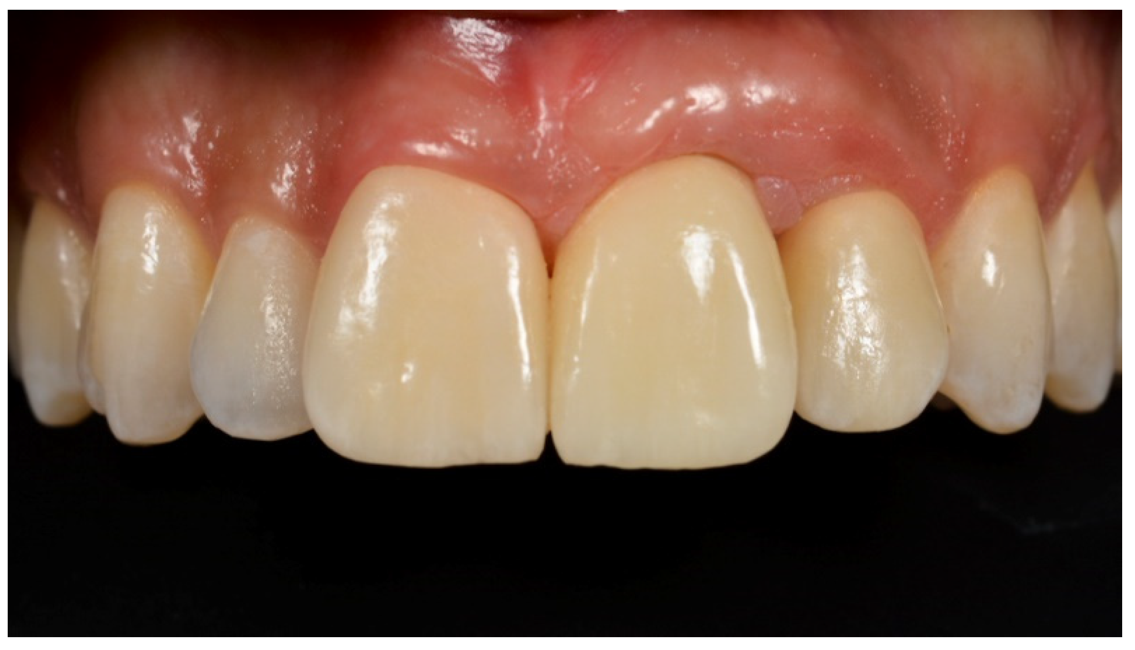 Prosthesis 03 00021 g018