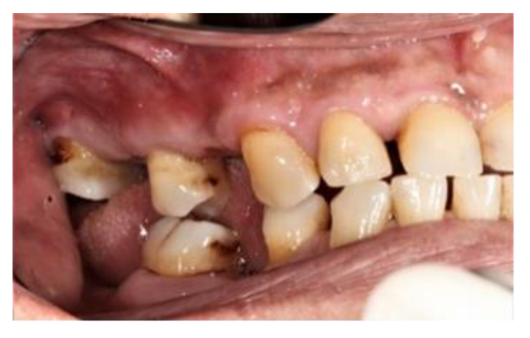 Prosthesis 03 00038 g002