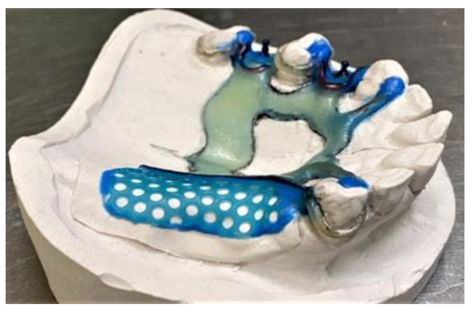 Prosthesis 03 00038 g011