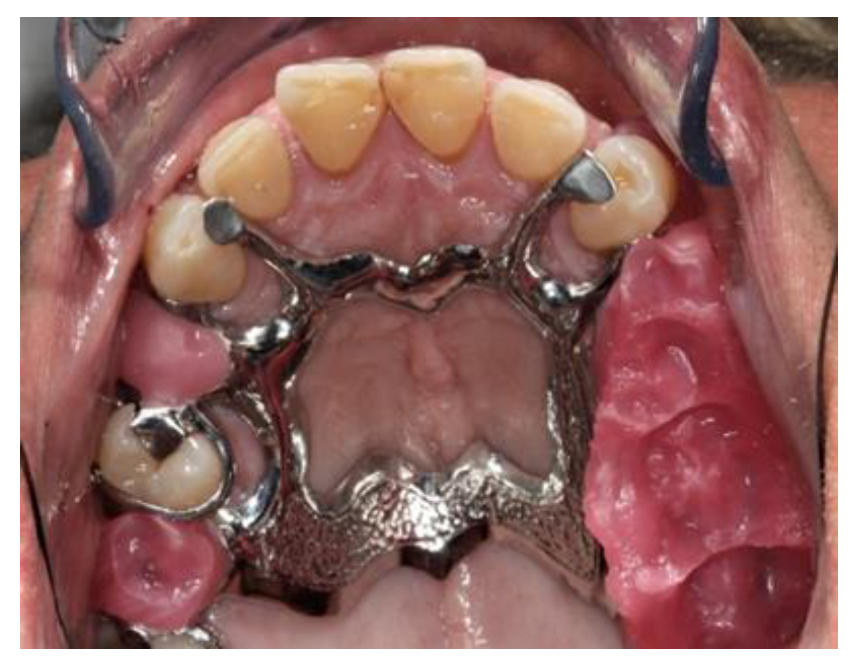 Prosthesis 03 00038 g018
