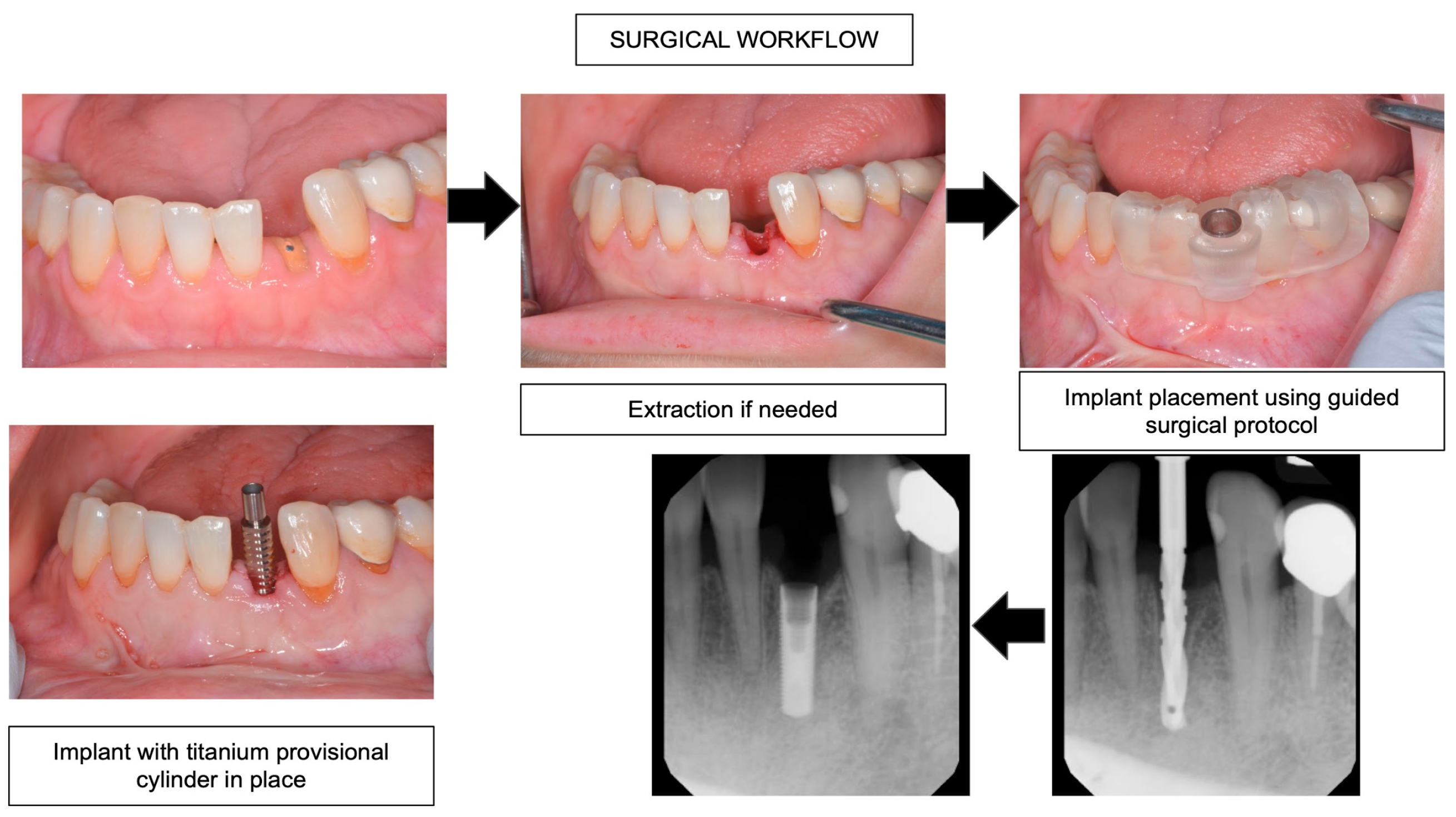 Prosthesis 05 00015 g002 Prosthesis 05 00015 g002