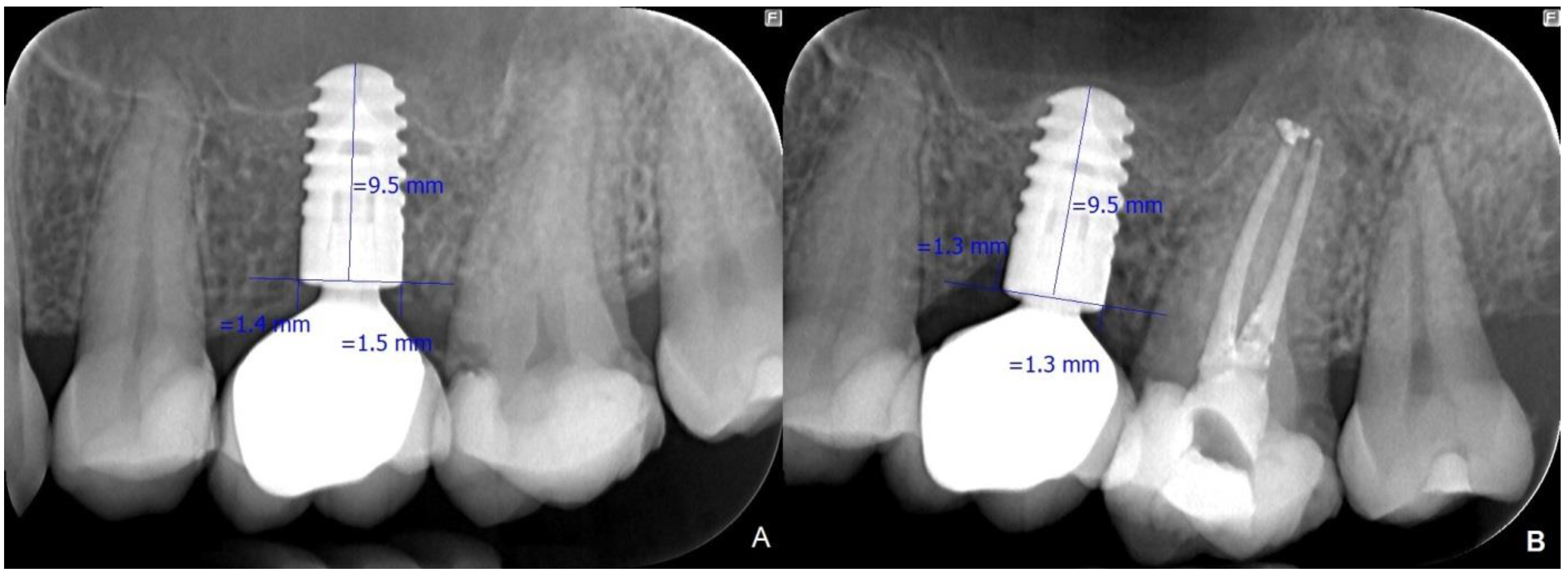 Prosthesis 05 00030 g002 Prosthesis 05 00030 g002