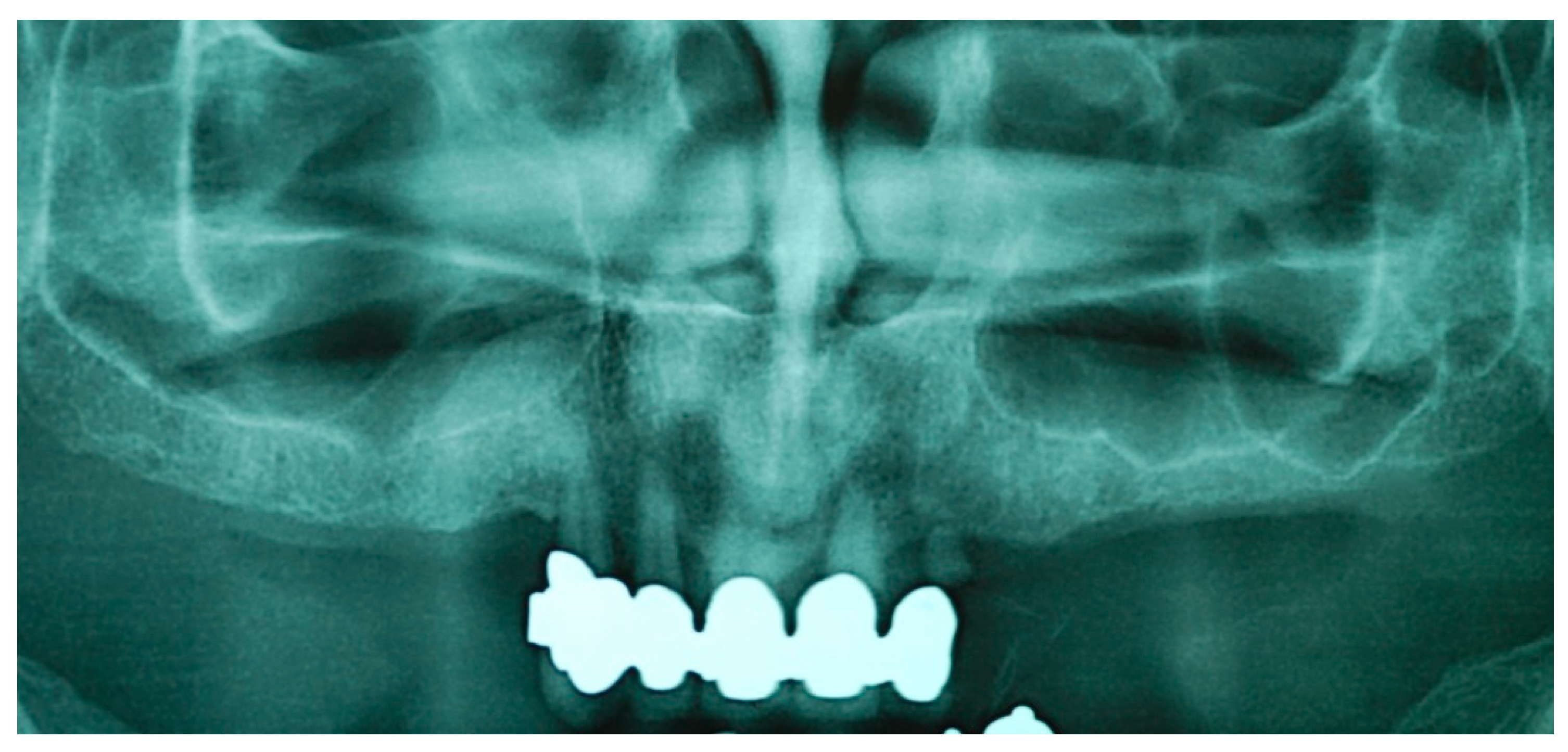 Prosthesis 05 00034 g002 Prosthesis 05 00034 g002