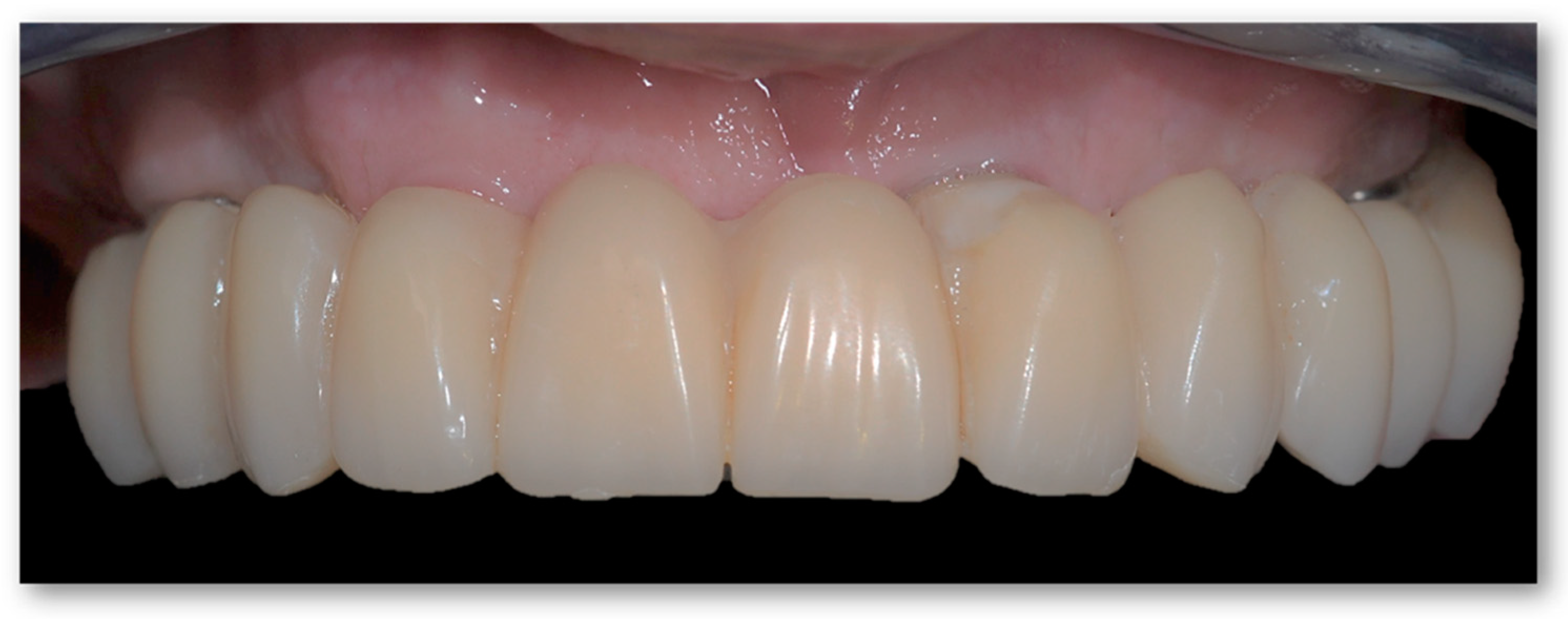 Prosthesis 05 00034 g004 Prosthesis 05 00034 g004