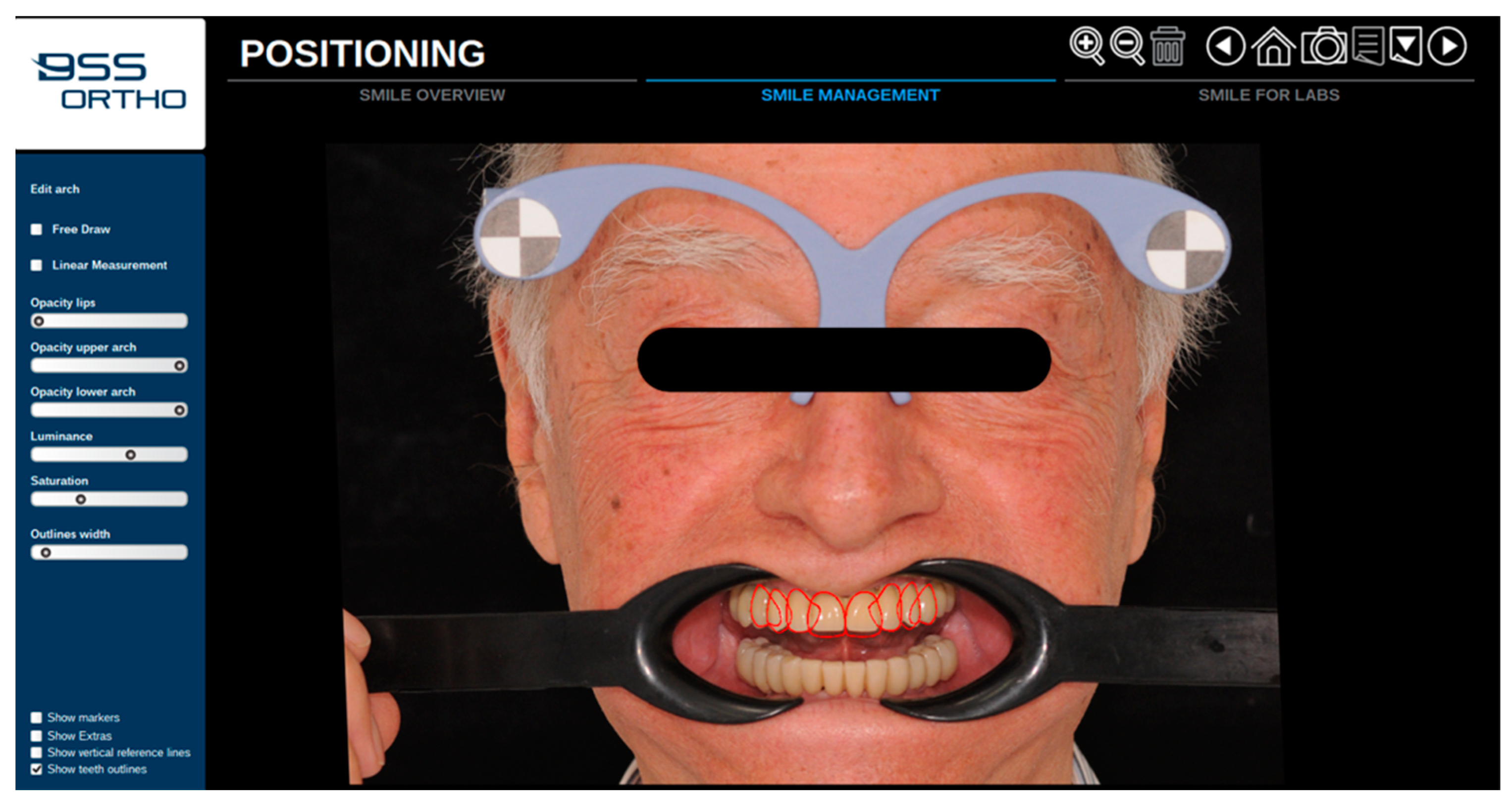 Prosthesis 05 00034 g006 Prosthesis 05 00034 g006