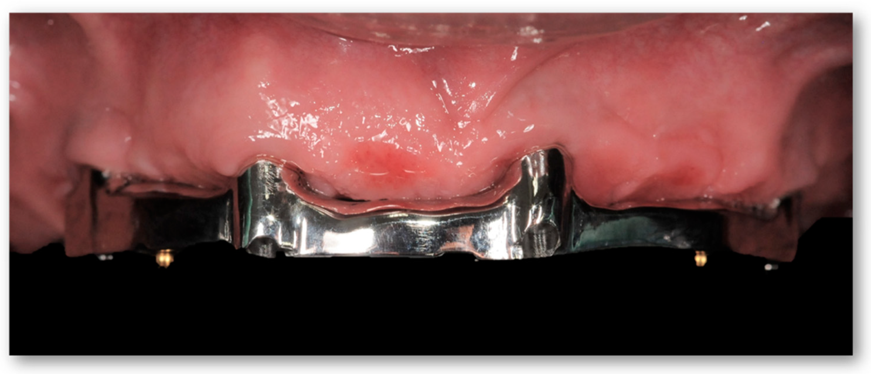 Prosthesis 05 00034 g011 Prosthesis 05 00034 g011