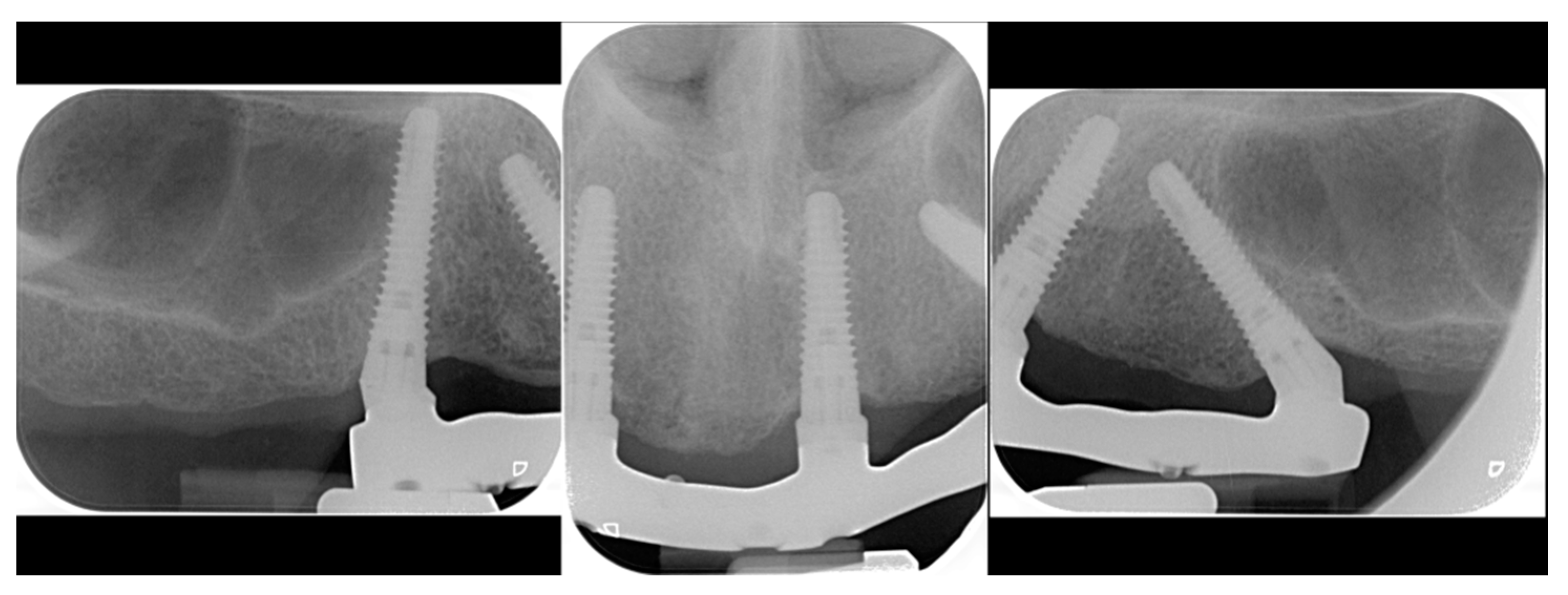 Prosthesis 05 00034 g012 Prosthesis 05 00034 g012