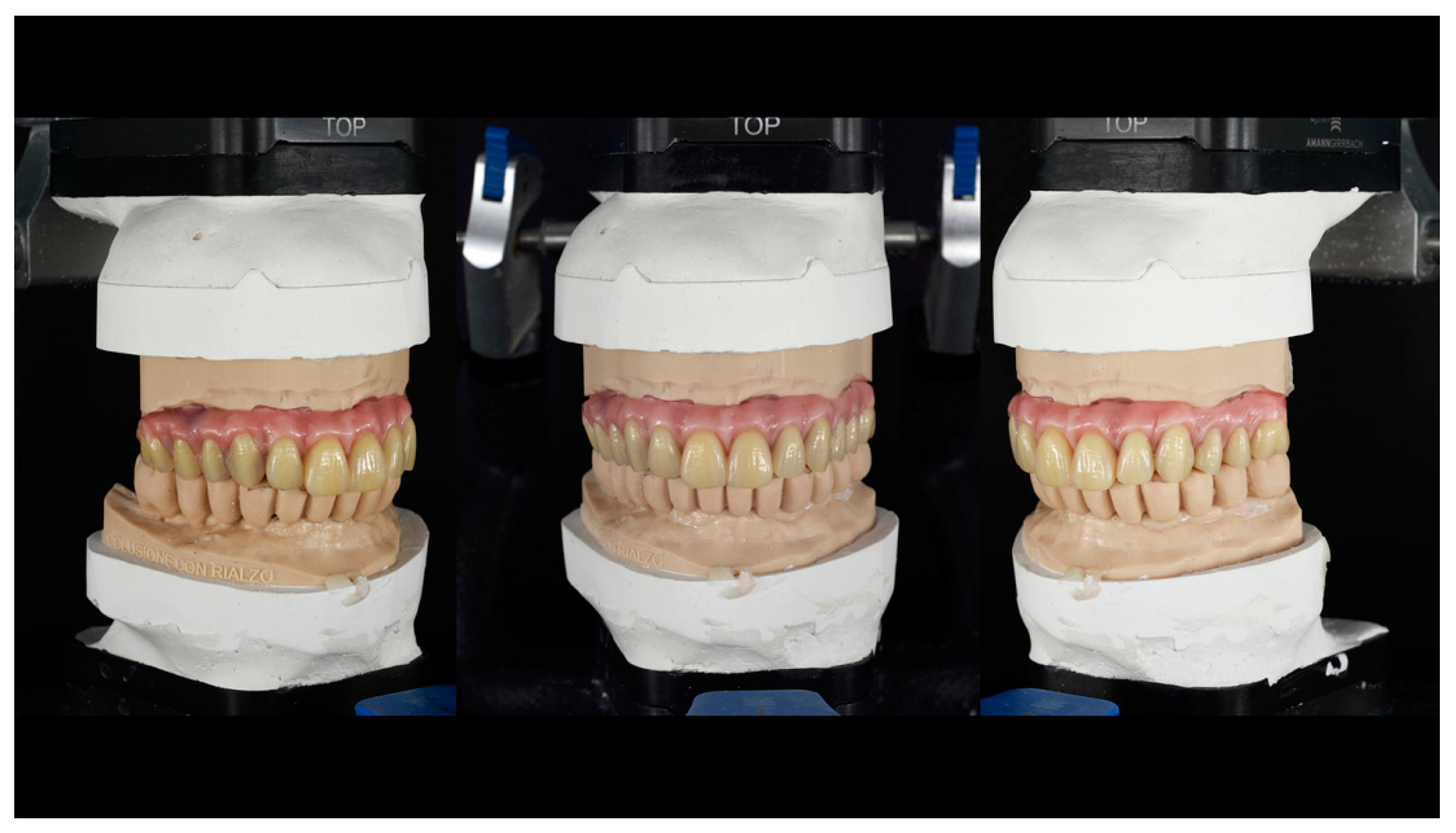 Prosthesis 05 00034 g014 Prosthesis 05 00034 g014
