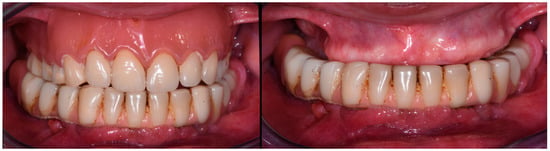 Prosthesis | Free Full-Text | Management of a Malpractice Dental ...