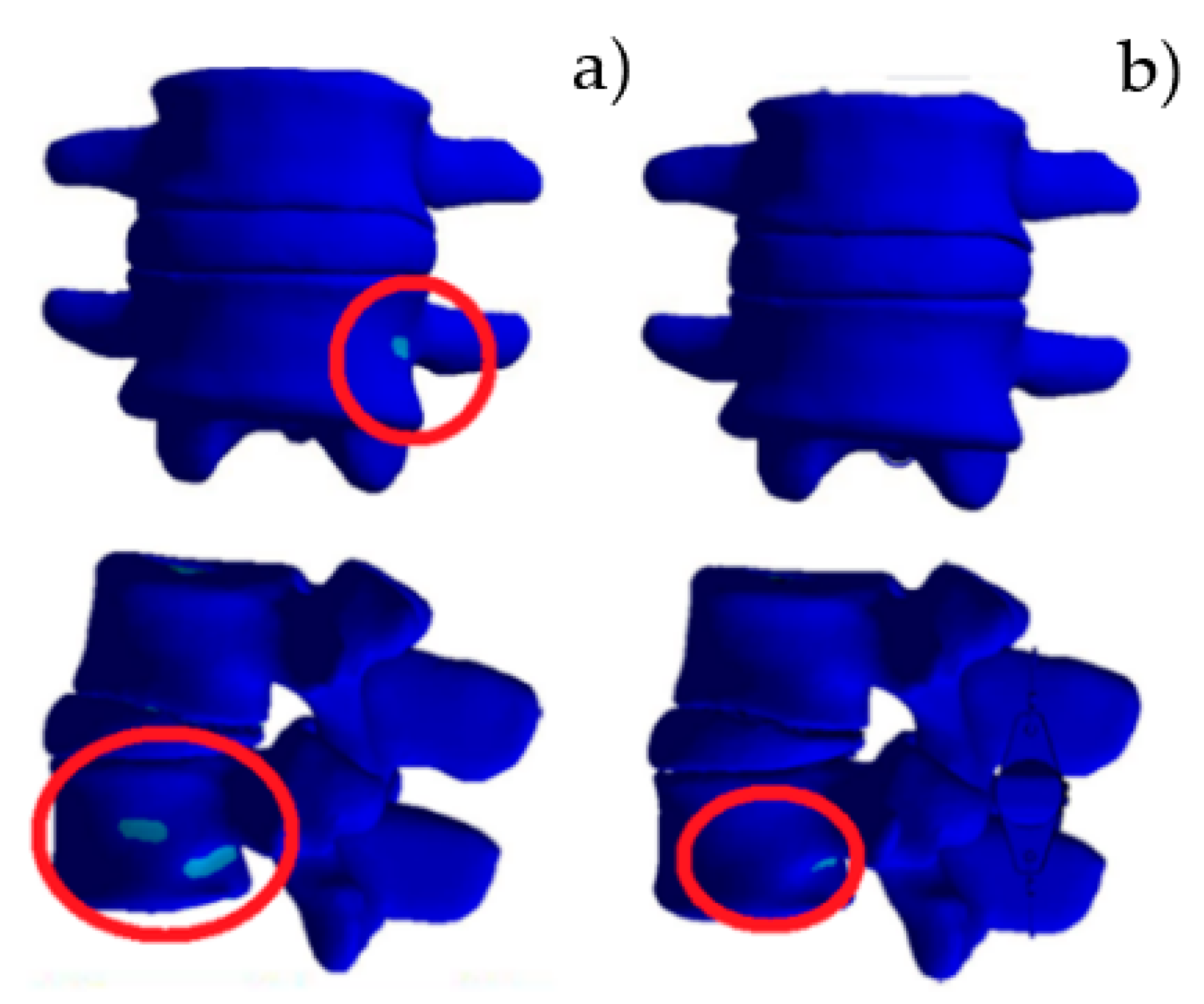 Prosthesis 05 00065 g008 Prosthesis 05 00065 g008