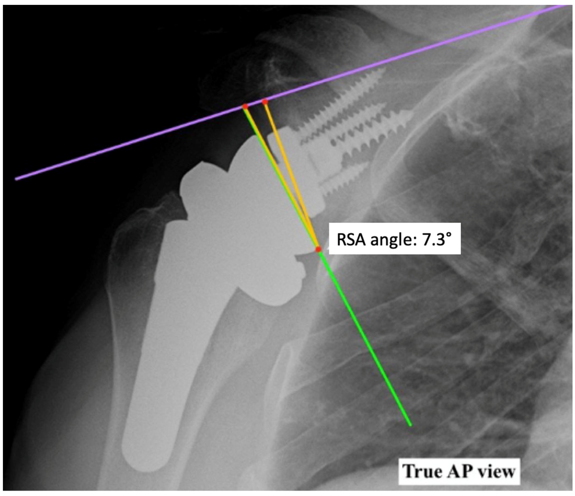 Prosthesis 05 00075 g009