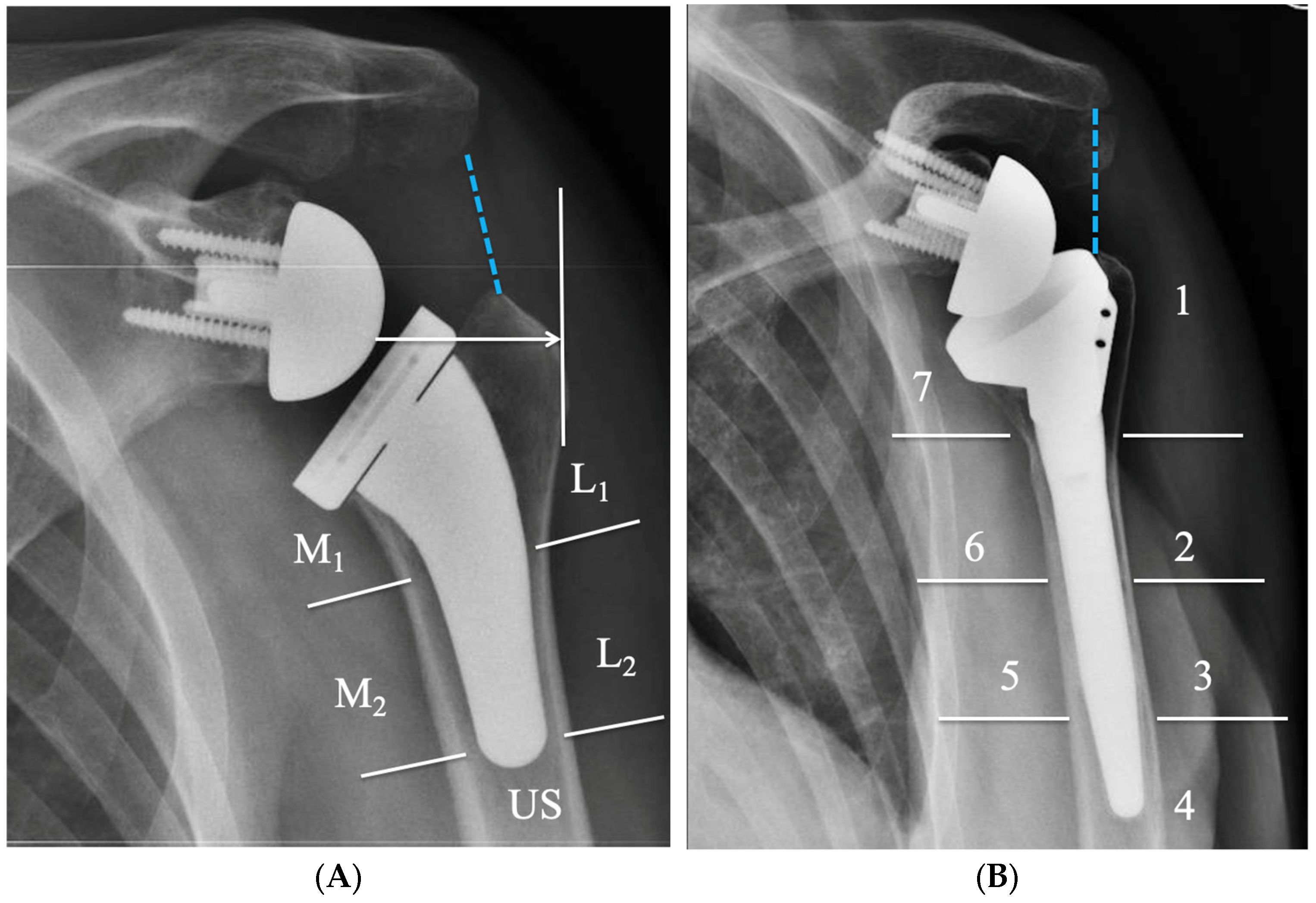 Prosthesis 05 00075 g010