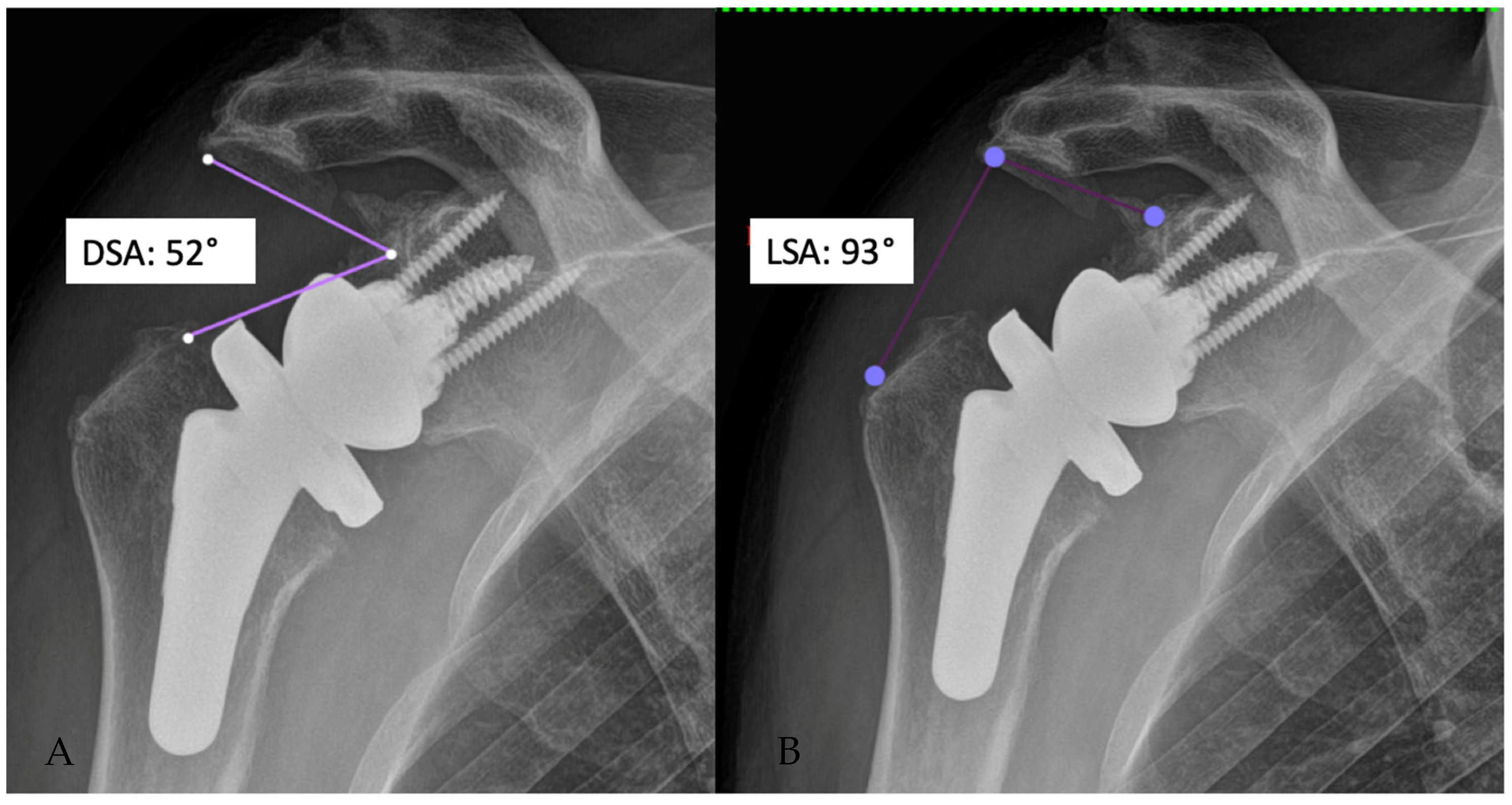 Prosthesis 05 00075 g011