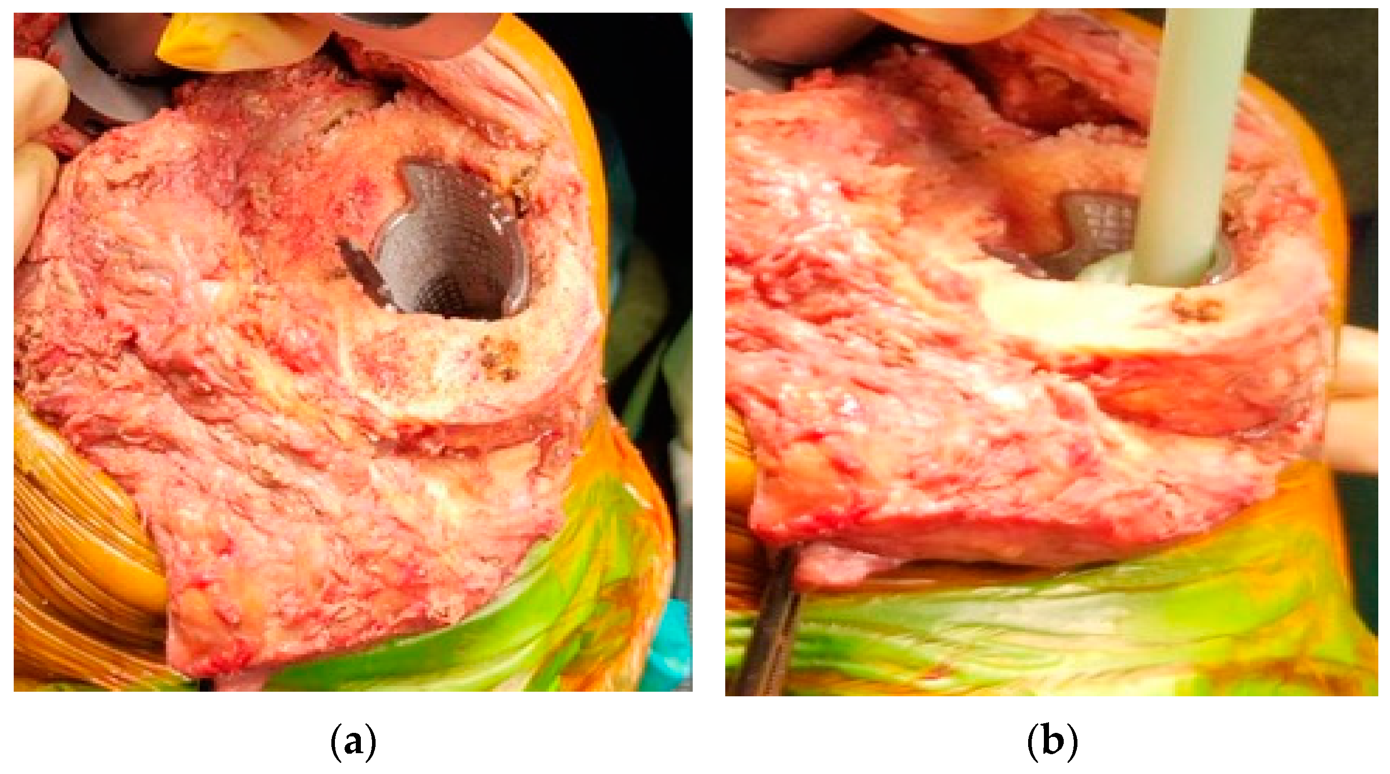 Prosthesis 05 00082 g002