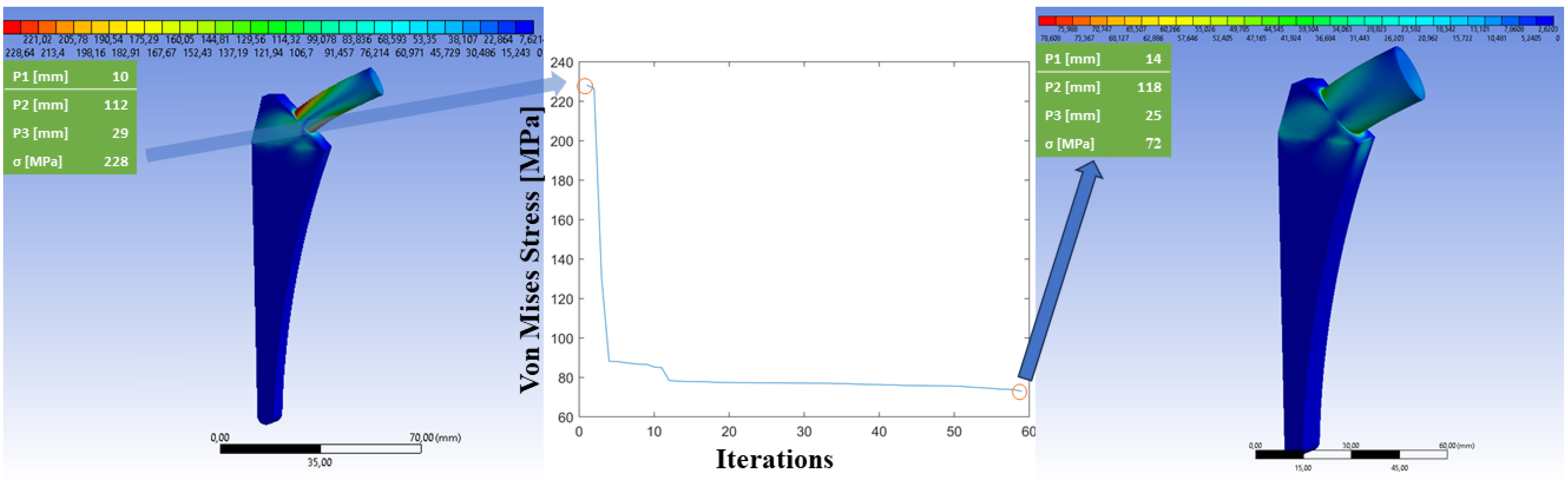 Prosthesis Free Full Text Smart Design Of Hip Replacement Prostheses Using Additive 1268