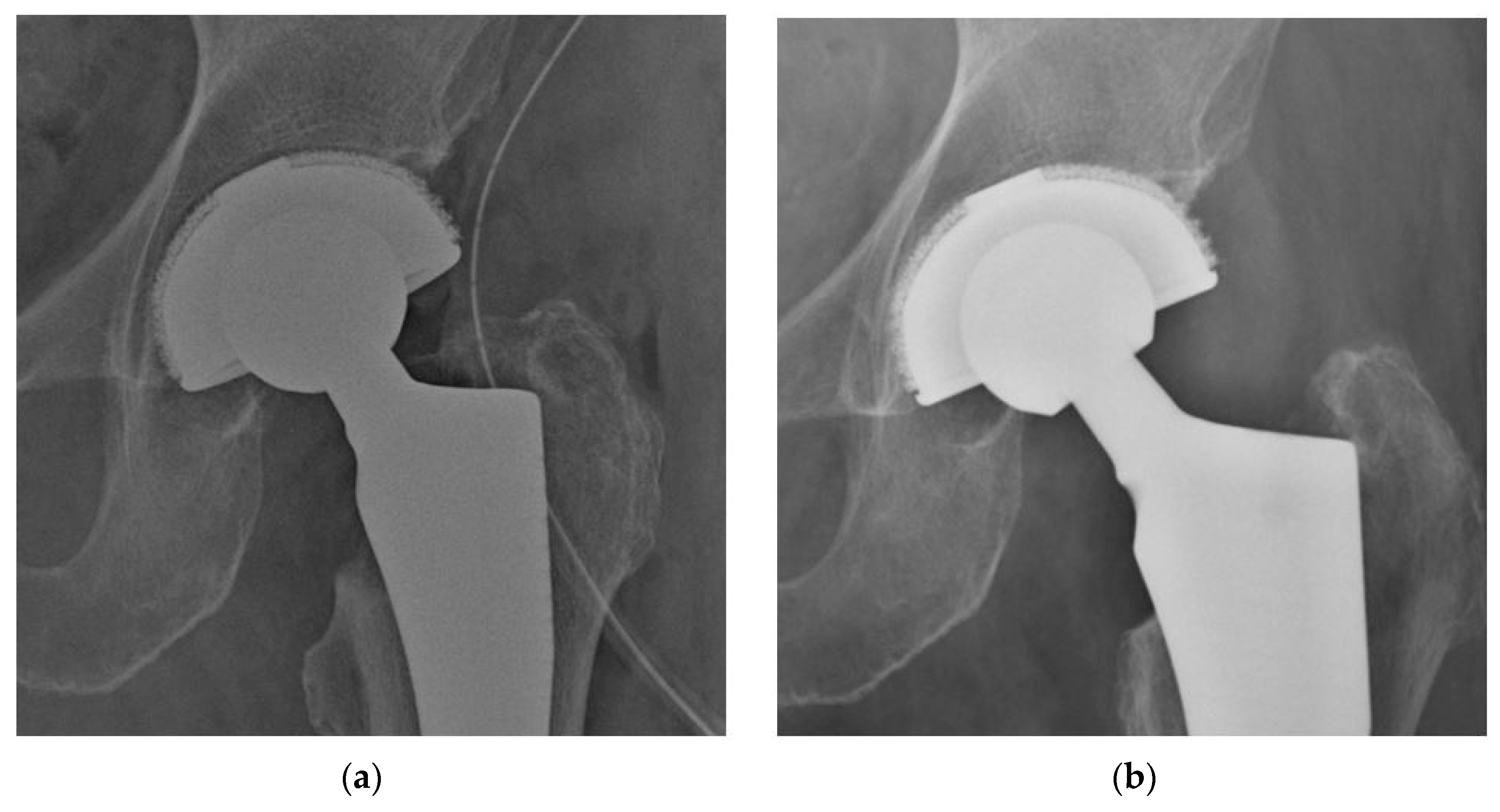Prosthesis 06 00029 g003