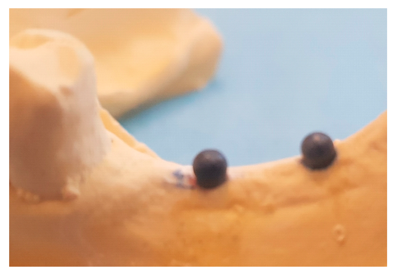 Prosthesis 06 00039 g001