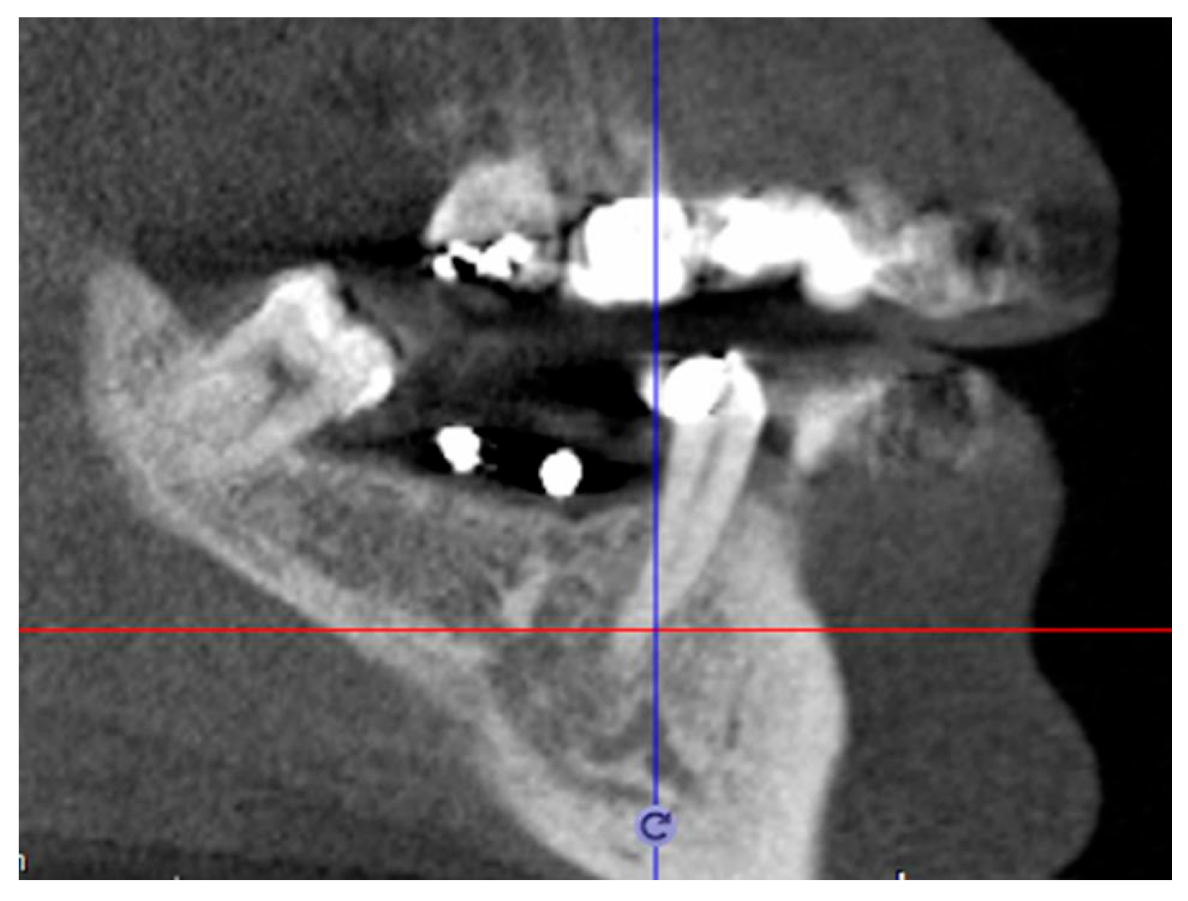 Prosthesis 06 00039 g003