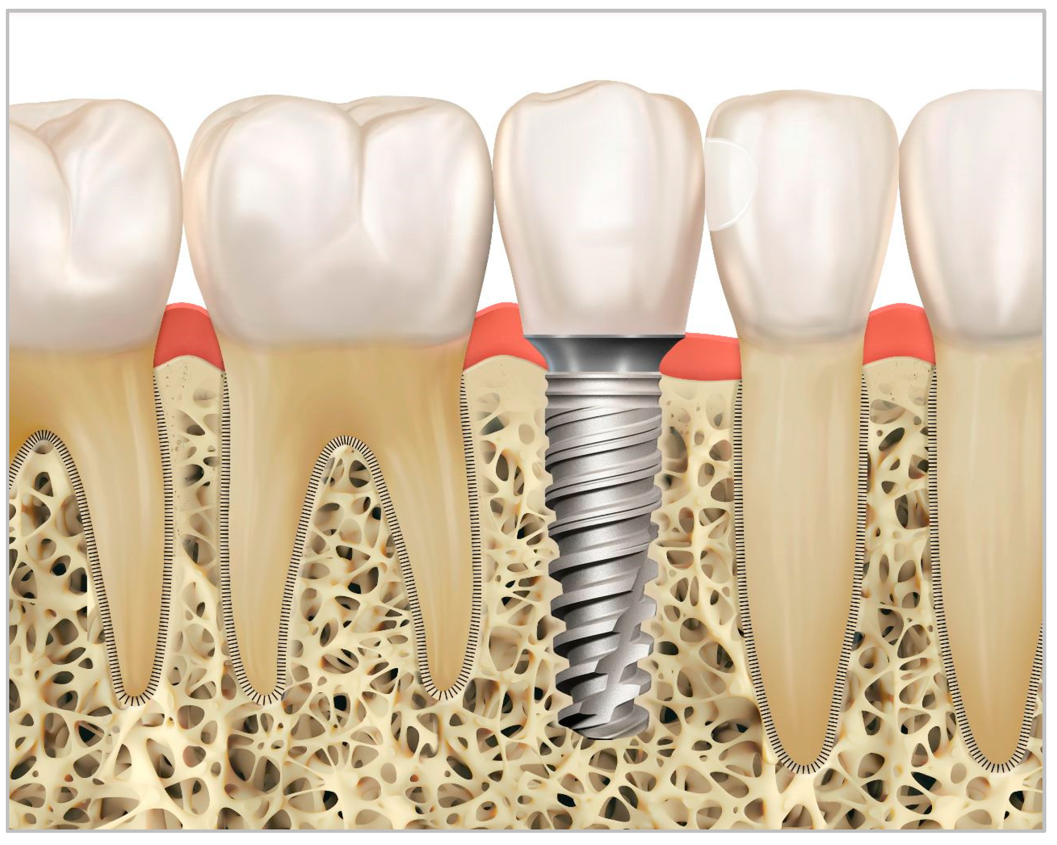 Prosthesis 06 00059 g008