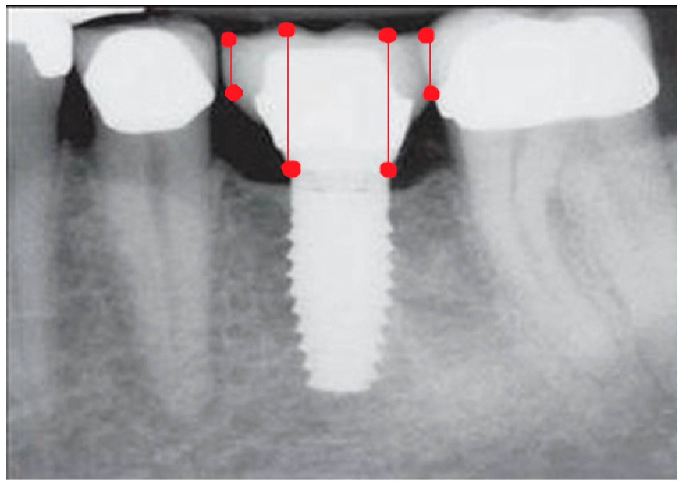 Prosthesis 06 00065 g005