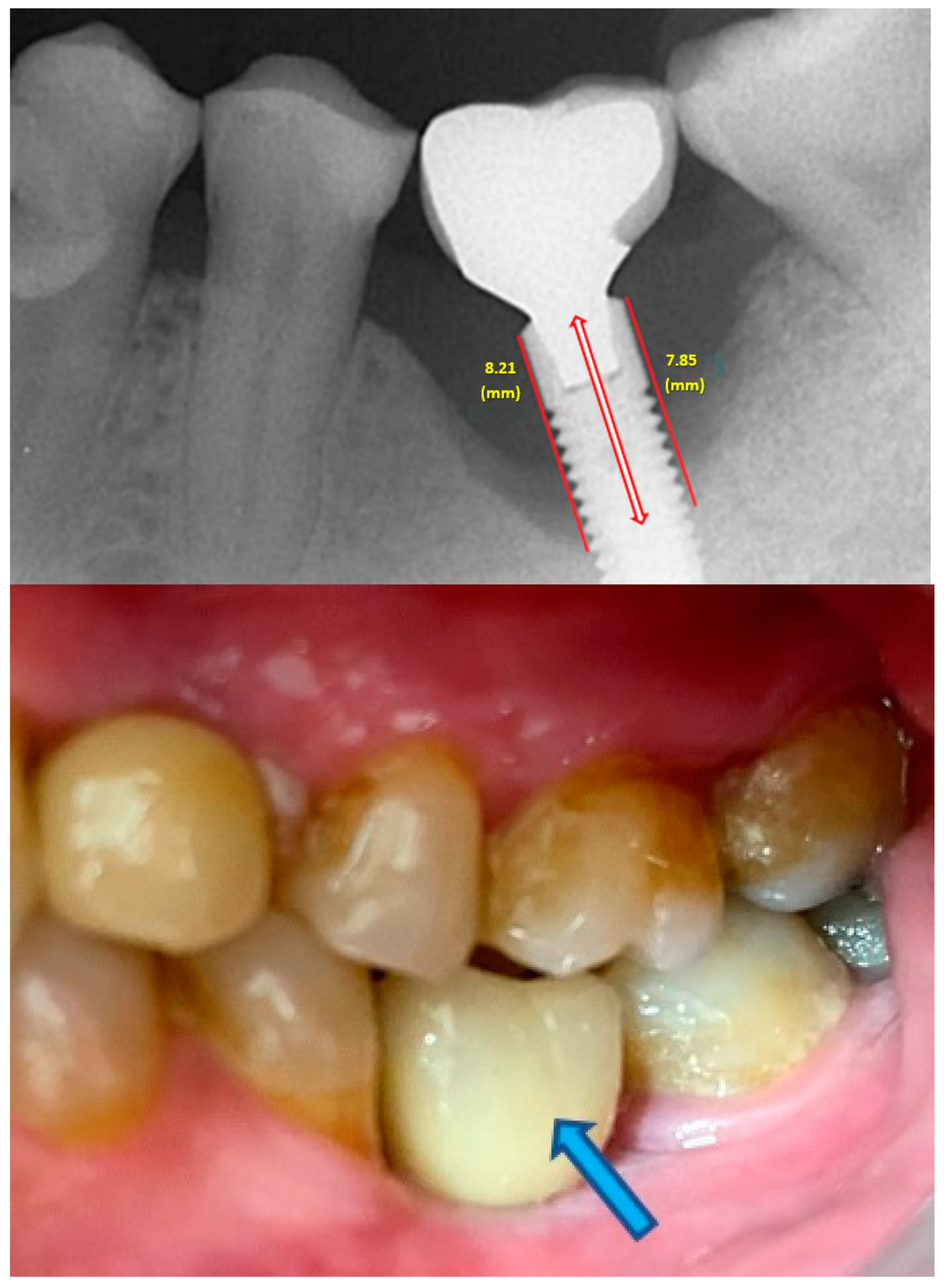 Prosthesis 06 00065 g008
