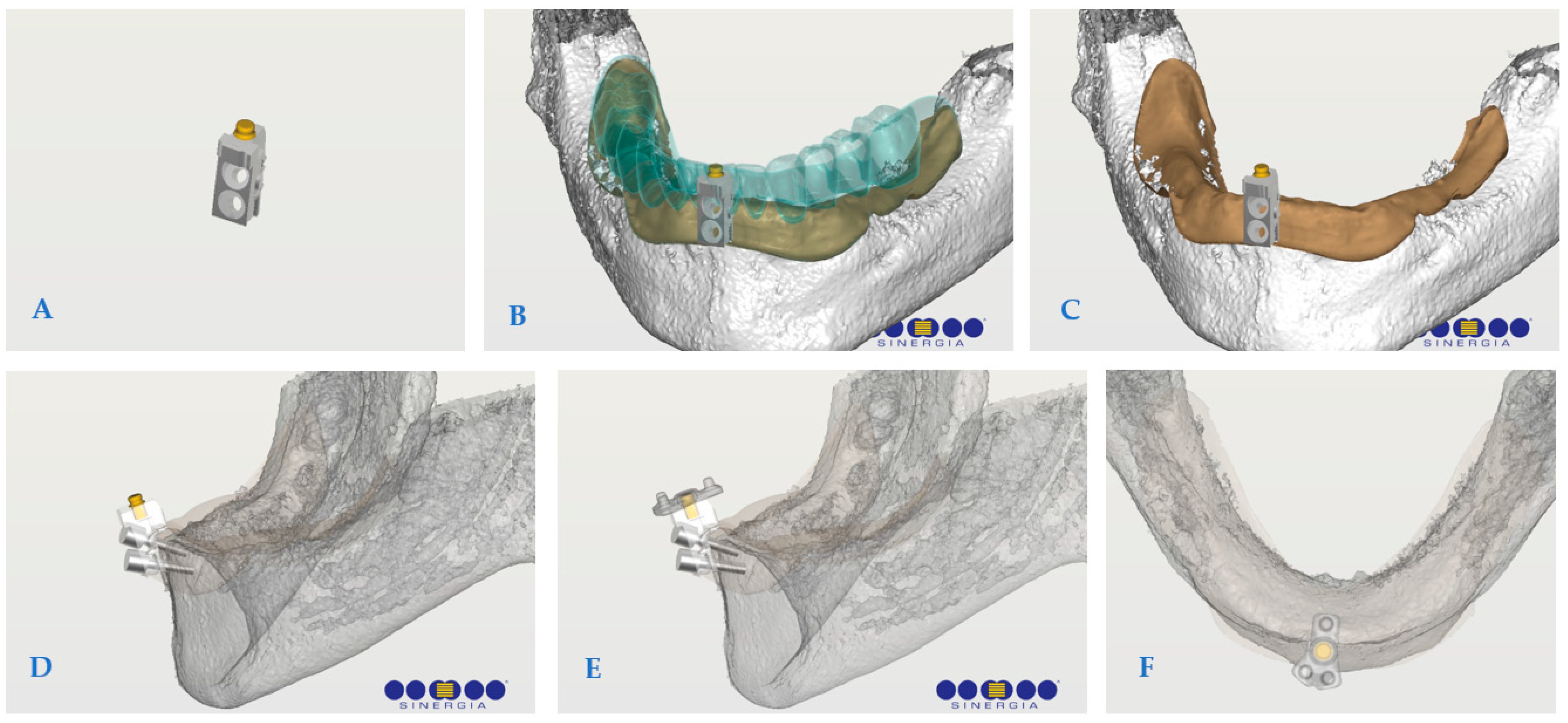Prosthesis 06 00107 g002