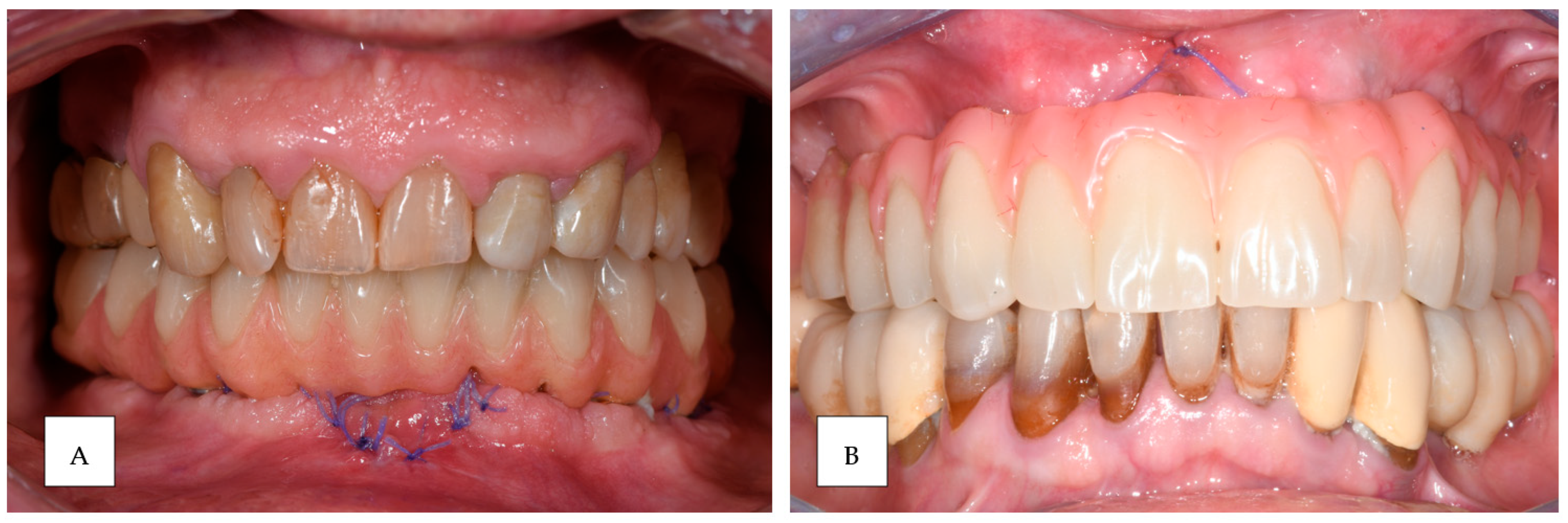 Prosthesis 06 00107 g011