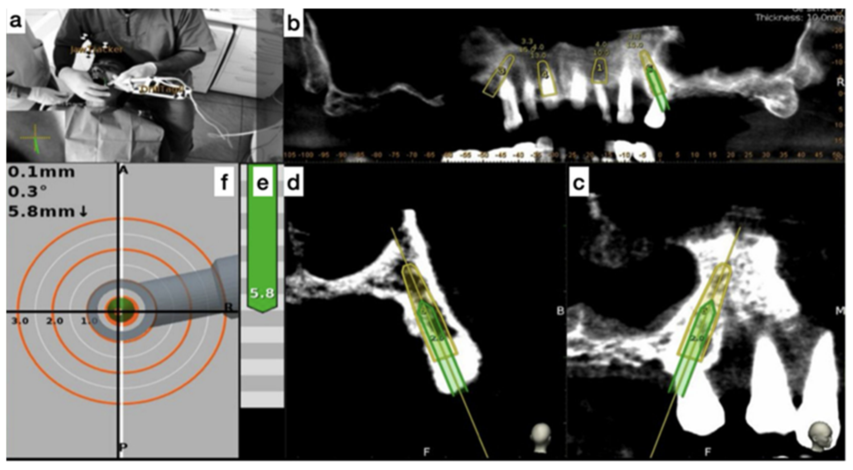 Prosthesis 07 00085 g007