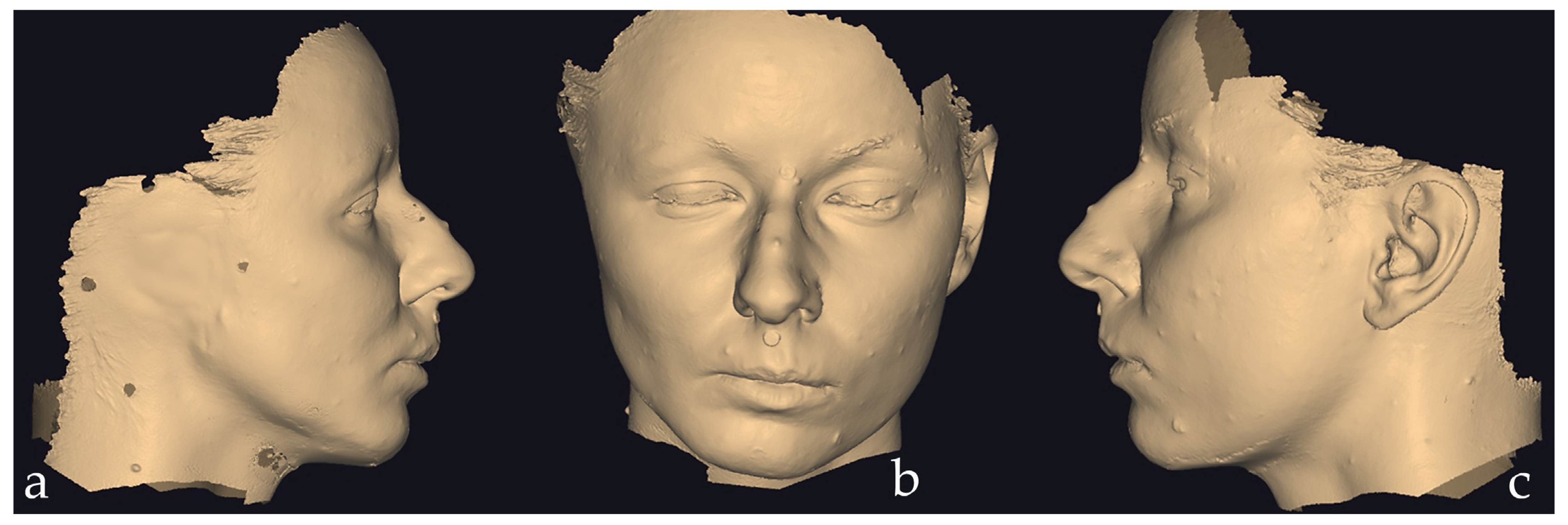Prosthesis 07 00114 g001 Prosthesis 07 00114 g001
