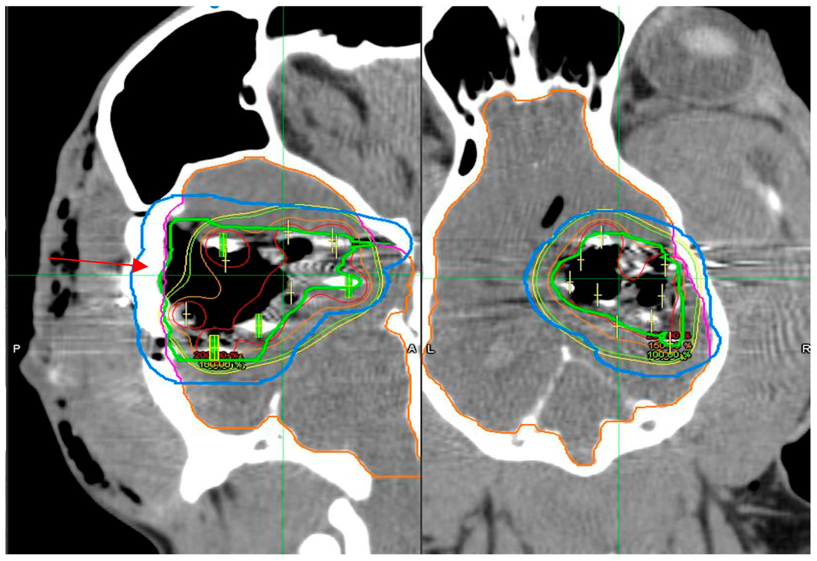 Radiation 05 00013 g007