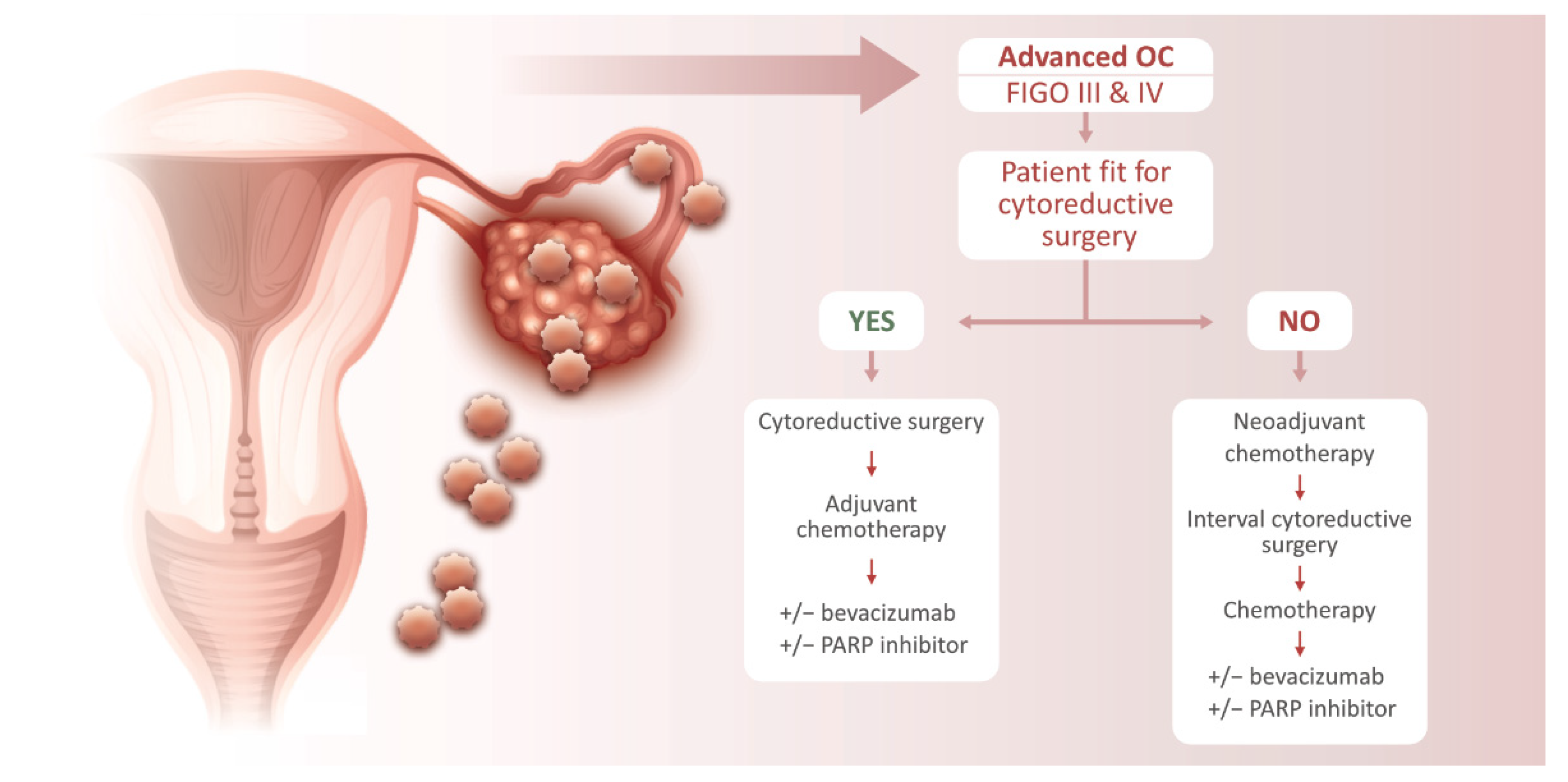 Reprod. Med. | Free Full-Text | Ovarian Cancer: Treatment and Resistance to  Pharmacotherapy | HTML