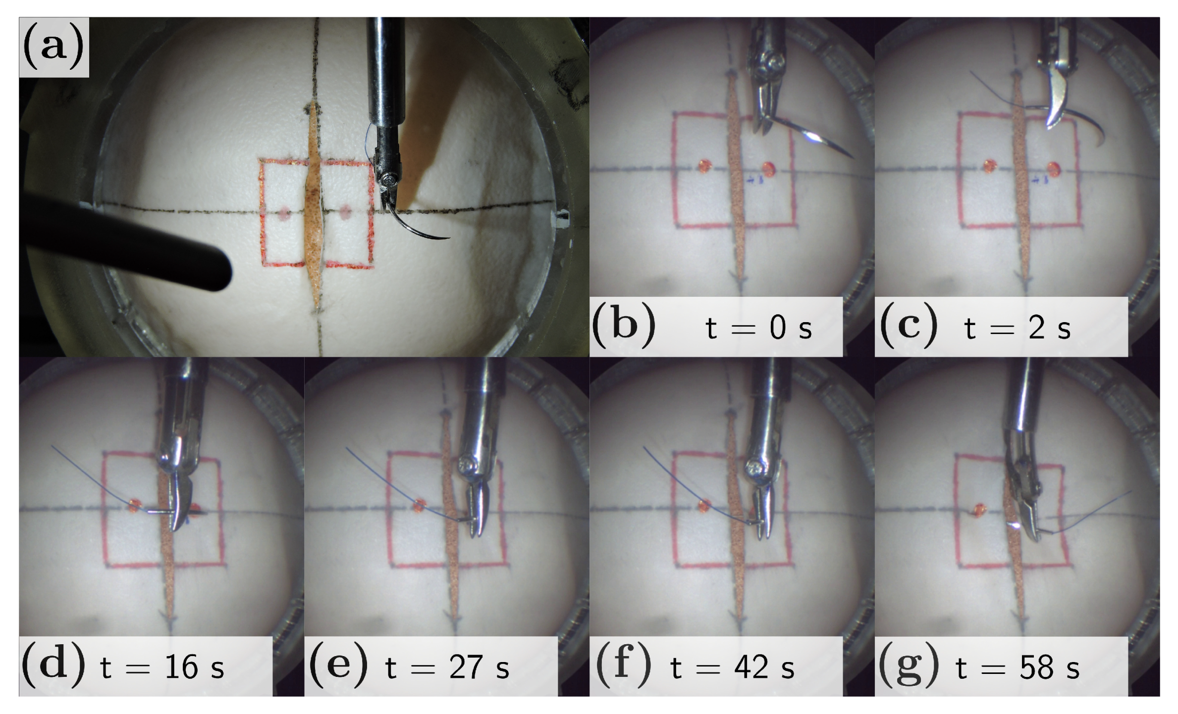 Robotics Free Full Text Optimization Based Constrained Trajectory Generation For Robot Assisted Stitching In Endonasal Surgery Html