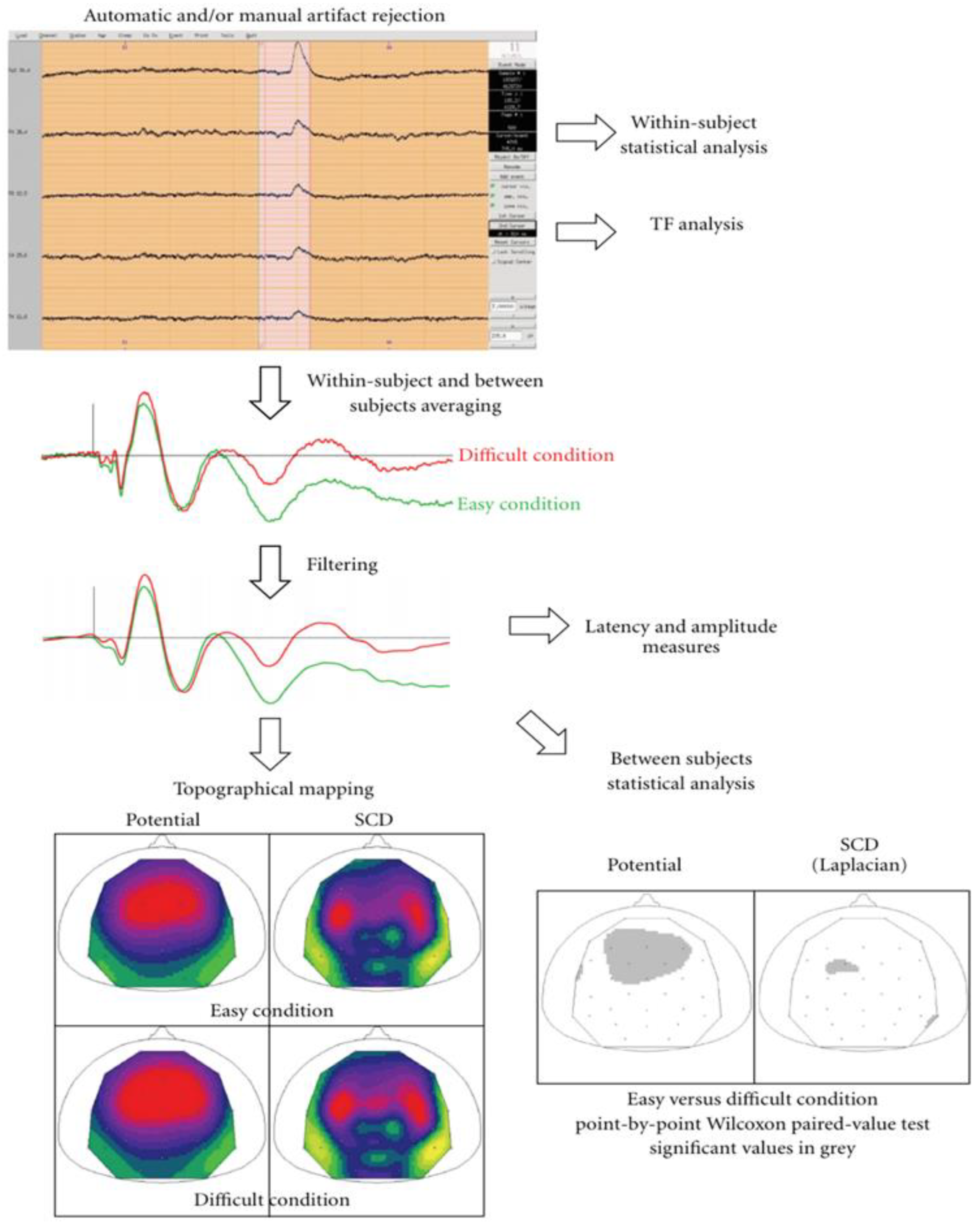 Sci | Free Full-Text | A Survey on EEG Data Analysis Software