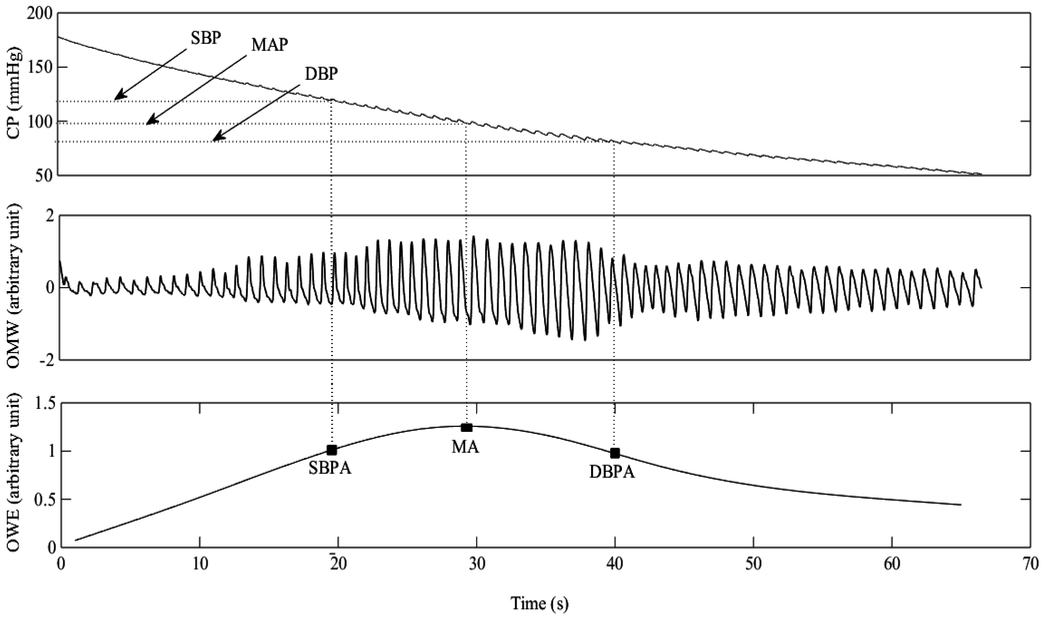 Sensors | Free Full-Text | Improved Measurement of Blood Pressure by  Extraction of Characteristic Features from the Cuff Oscillometric Waveform