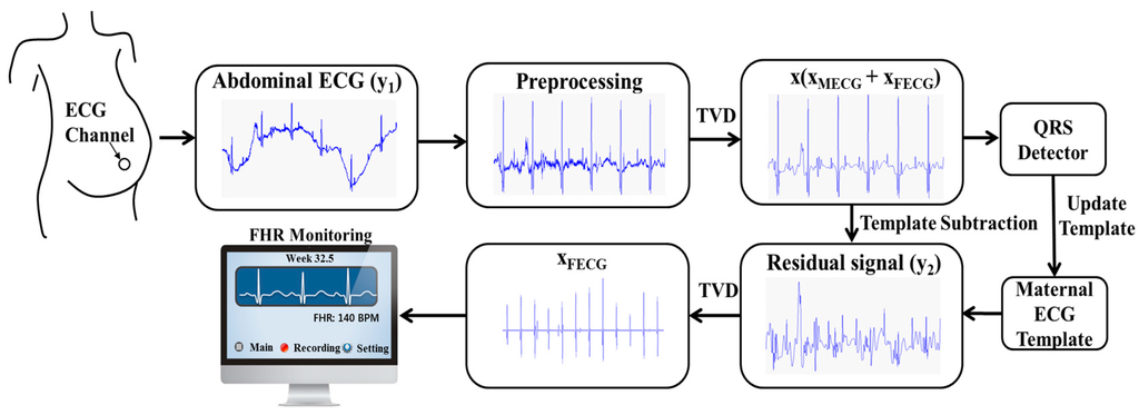 Sensors | Free Full-Text | Sequential Total Variation Denoising for the  Extraction of Fetal ECG from Single-Channel Maternal Abdominal ECG | HTML