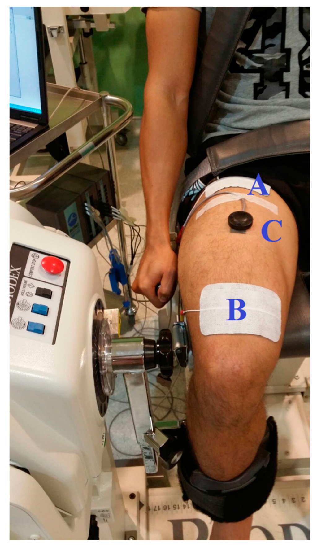 Sensors | Free Full-Text | Estimation of Electrically-Evoked Knee Torque  from Mechanomyography Using Support Vector Regression