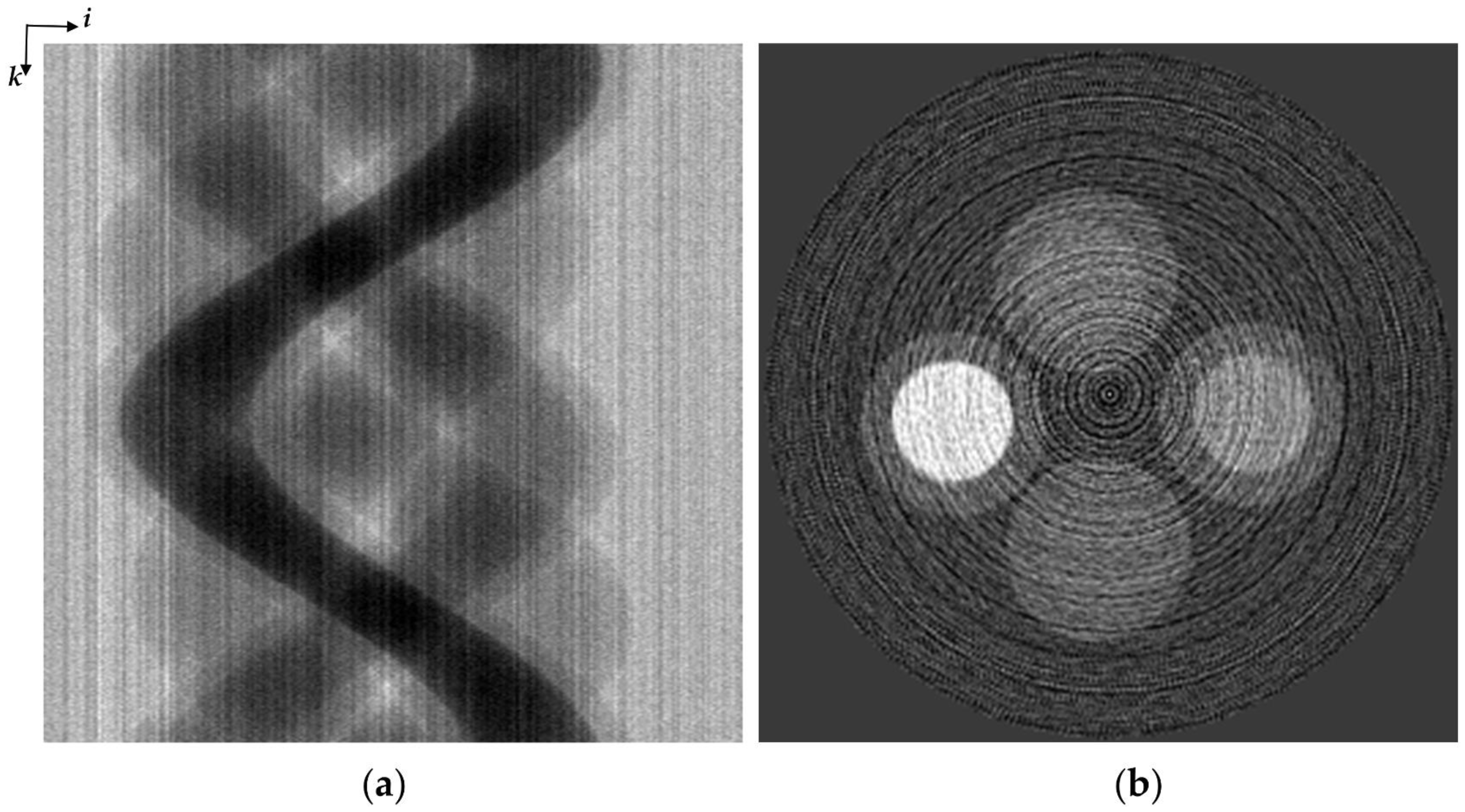 Sensors | Free Full-Text | A Ring Artifact Correction Method: Validation by  Micro-CT Imaging with Flat-Panel Detectors and a 2D Photon-Counting Detector