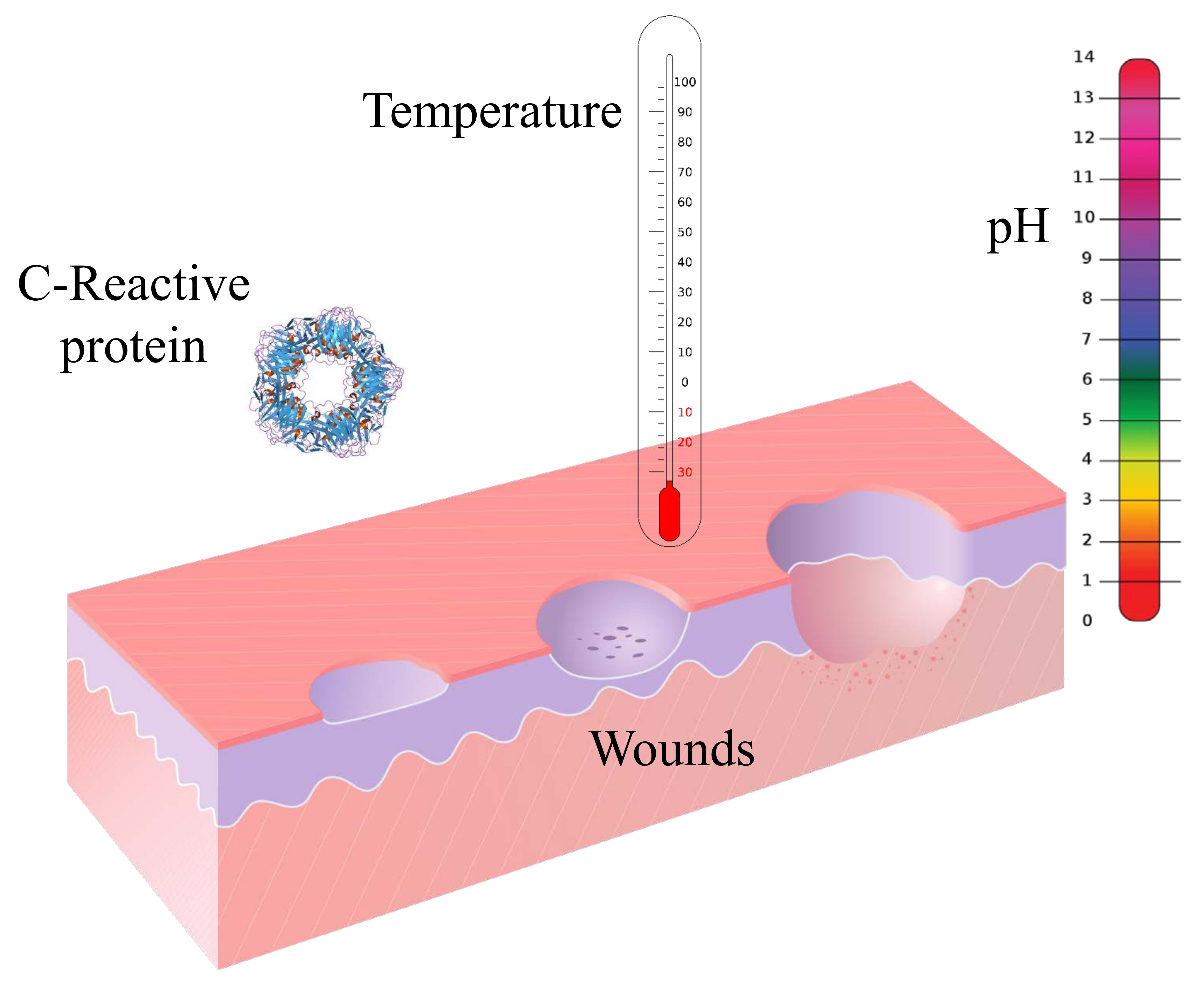 Sensors Free Full Text Sensors And Biosensors For C Reactive Protein Temperature And Ph And Their Applications For Monitoring Wound Healing A Review Html