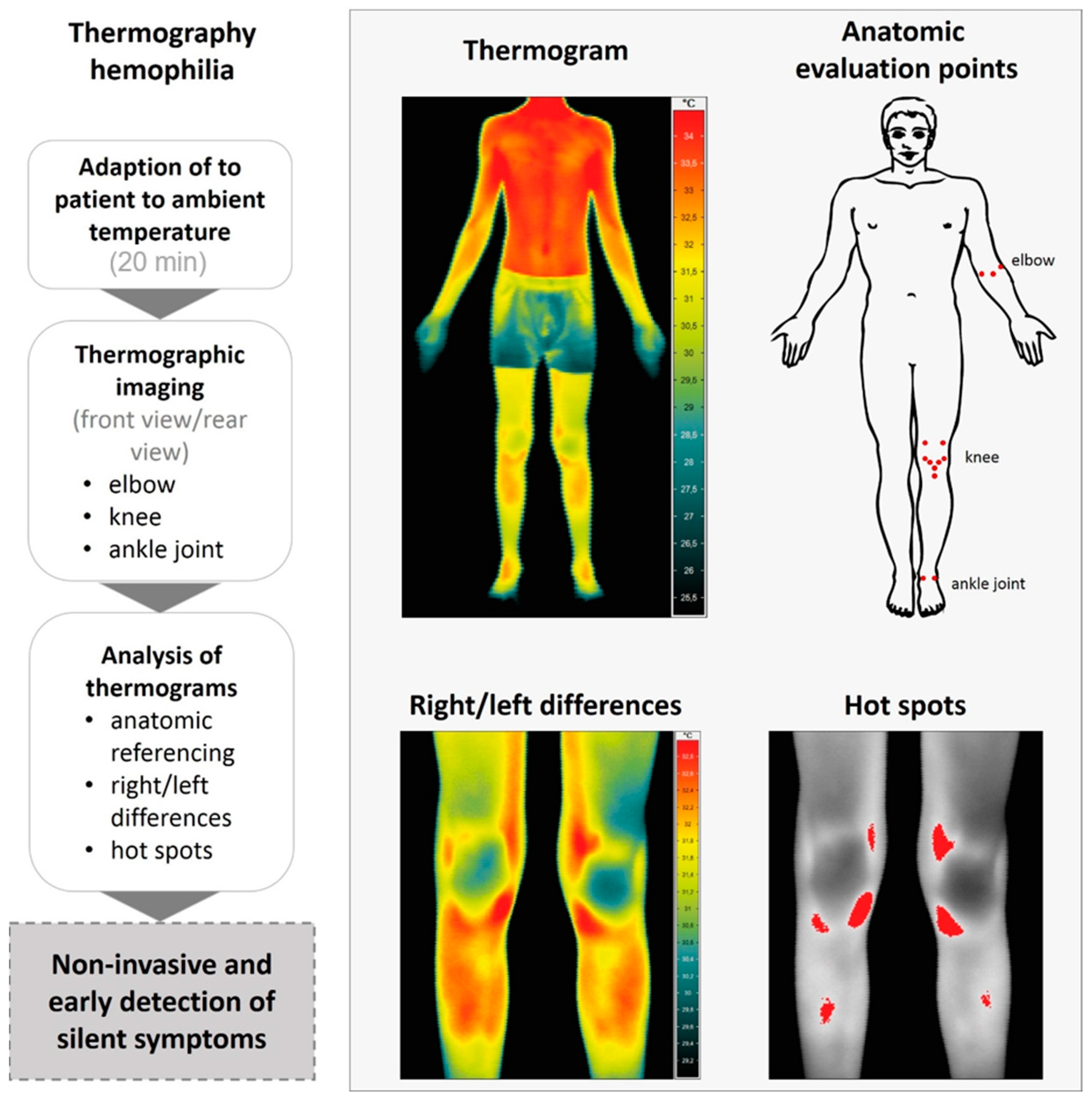 Sensors Free Full Text Infrared Thermography As A Non Invasive Tool