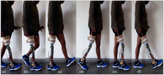 A cheaper, high-performance prosthetic knee, MIT News