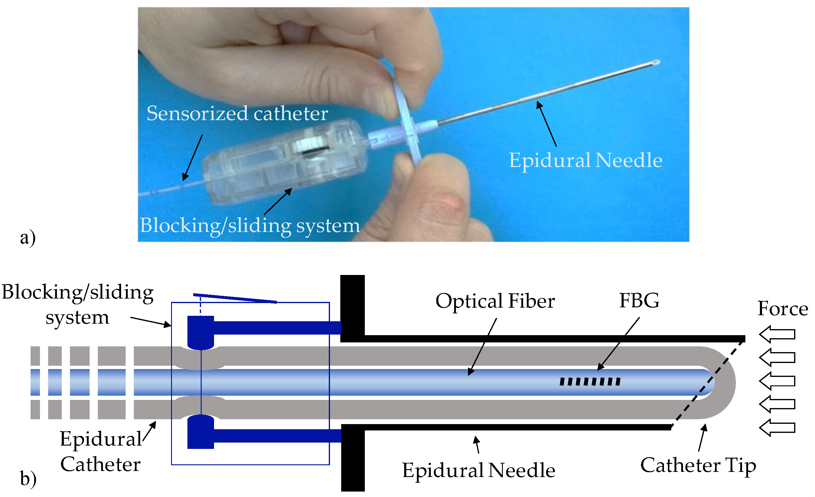 Sensors | Free Full-Text | Smart Optical Catheters for Epidurals | HTML