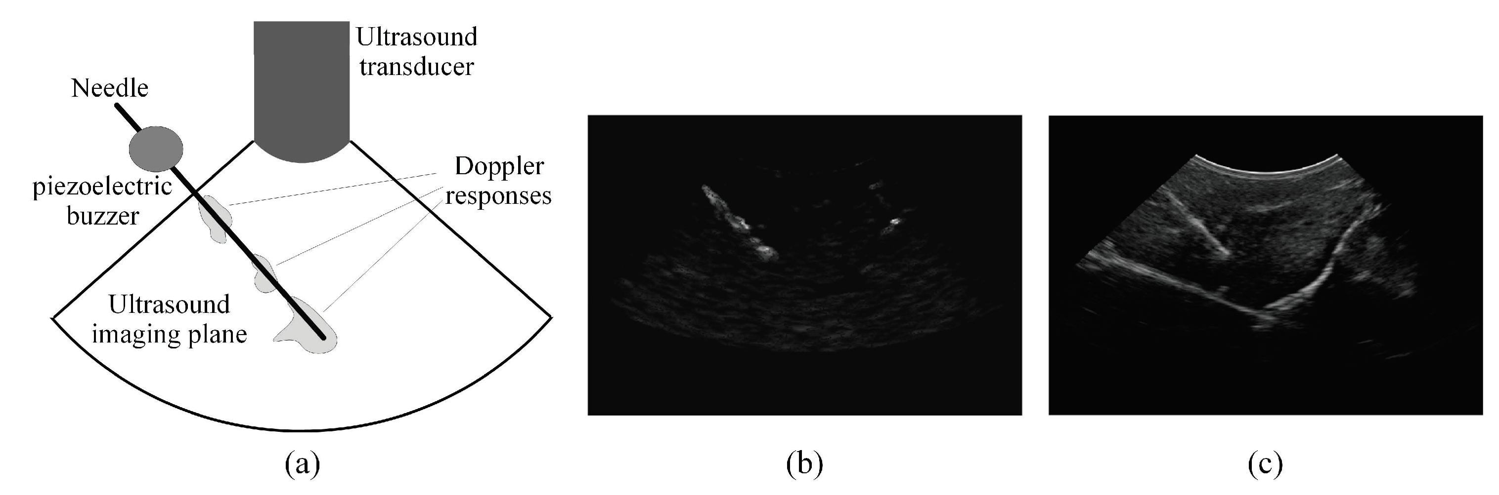 Sensors | Free Full-Text | Accurate Needle Localization Using Two