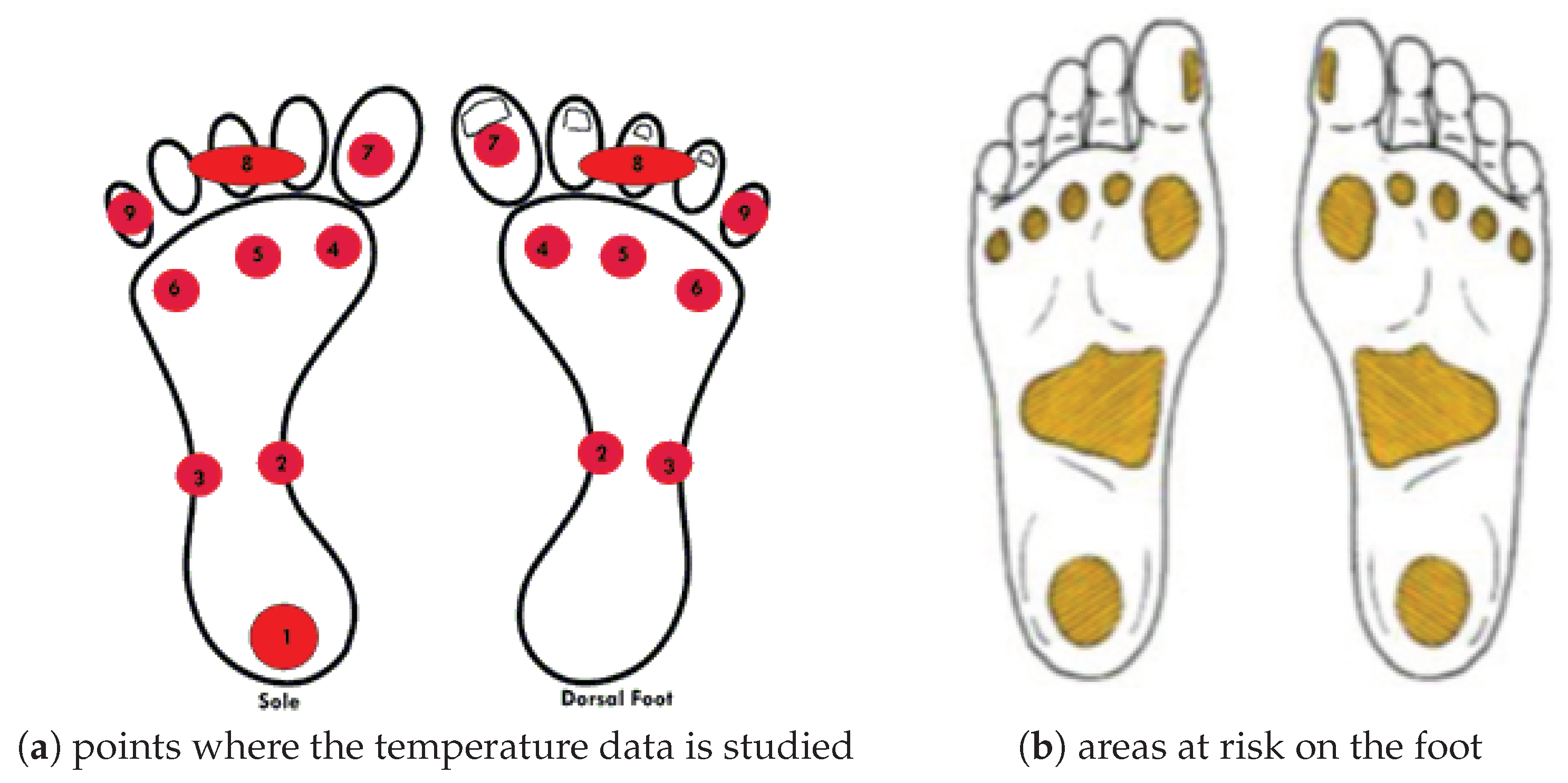 Diabetic Foot Care Spring TX  Foot Temperature MonitoringLouetta Foot &  Ankle Specialists