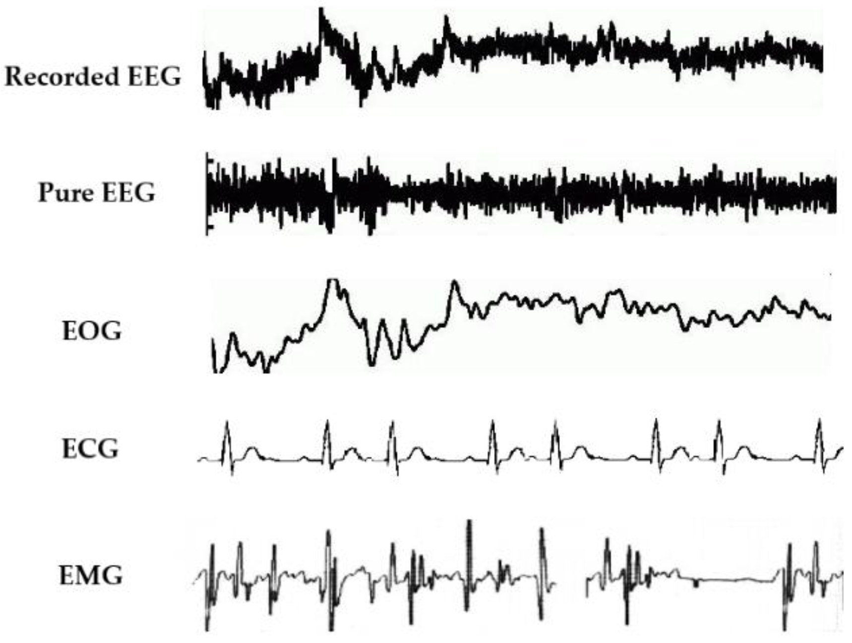 As Shown By Eeg Recordings Of New Practitioners