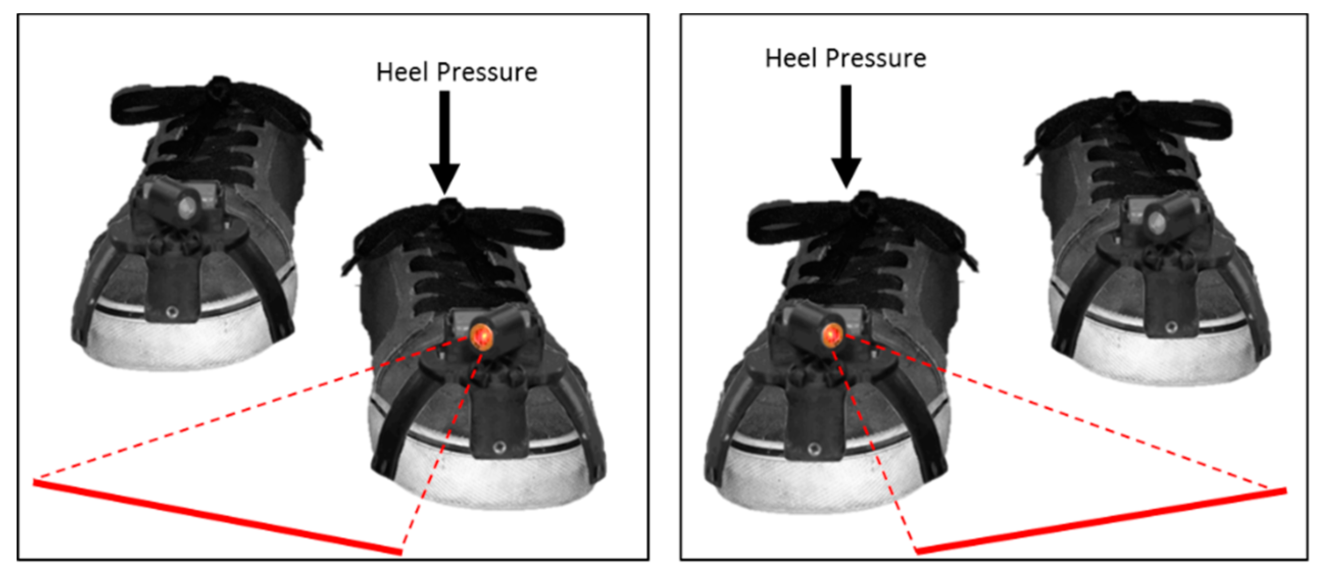 Sensors | Free Full-Text | A Technological Review of Wearable Cueing  Devices Addressing Freezing of Gait in Parkinson's Disease | HTML
