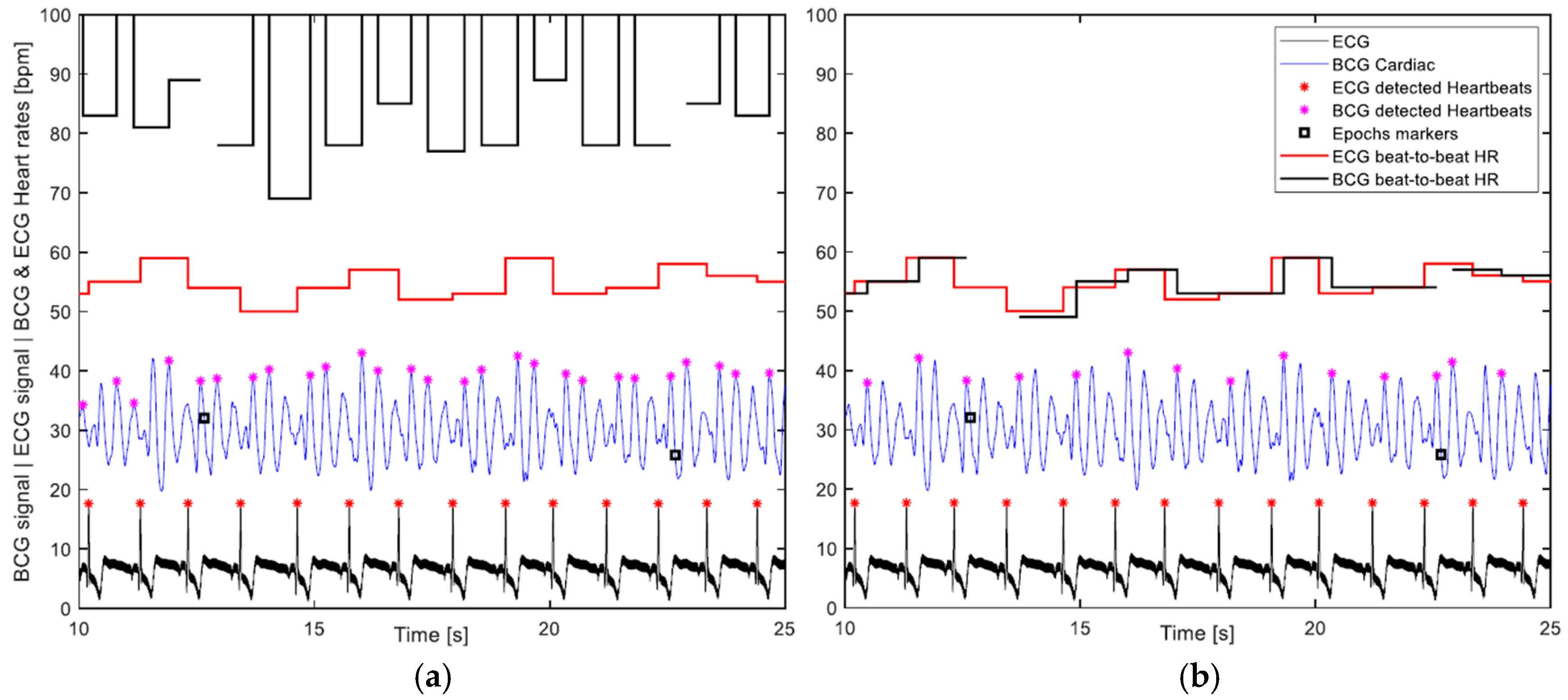 Sensors Free Full Text Bed Embedded Heart And Respiration