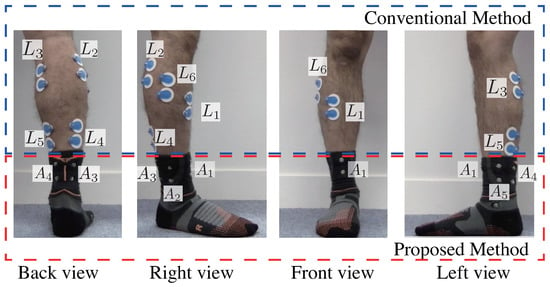 emg test of ankle and knee pain