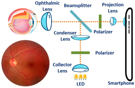 Sensors Free Full Text Smartphone Sensors For Health Monitoring And Diagnosis Html